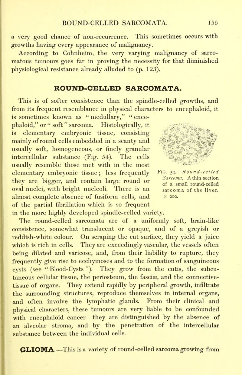 a very good chance of non-recurrence. This sometimes occurs with growths having every appearance of malignancy. According to Cohnheim_, the very varying malignancy of sarco- matous tumours goes far in proving the necessity for that diminished physiological resistance already alluded to (p. 123). ROUND-CELLED SARCOMATA. This is of softer consistence than the spindle-celled growths, and from its frequent resemblance in physical characters to encephaloid, it is sometimes known as  medullary/'  ence- phaloid/' or  soft  sarcoma. Histologically, it is elementary embryonic tissue, consisting mainly of round cells embedded in a scanty and ' usually soft, homogeneous, or finely granular ' e-o ' intercellular substance (Fig. 54). The cells ''^'^{, usually resemble those met with in the most elementary embryonic tissue; less frequently Fig. Round-celled . i , . 1 . • 1 J Sarcoma. A thin section they are bicrffer, and contam larffe round or r „ j n j ^  of a small round-celled oval nuclei, with bright nucleoli. There is an sarcoma of the liver. almost complete absence of fusiform cells, and x 200. of the partial fibrillation which is so frequent in the more highly developed spindle-celled variety. The round-celled sarcomata are of a uniformly soft, brain-like consistence, somewhat translucent or opaque, and of a greyish or reddish-white colour. On scraping the cut surface, they yield a juice which is rich in cells. They are exceedingly vascular, the vessels often being dilated and varicose, and, from their liability to rupture, they frequently give rise to ecchymoses and to the formation of sanguineous cysts (see Blood-Cysts ). They grow from the cutis, the subcu- taneous cellular tissue, the periosteum, the fasciae, and the connective- tissue of organs. They extend rapidly by peripheral growth, infiltrate the surrounding structures, reproduce themselves in internal organs, and often involve the lymphatic glands. From their clinical and physical characters, these tumours are very liable to be confounded with encephaloid cancer—they are distinguished by the absence of an alveolar stroma, and by the penetration of the intercellular substance between the individual cells. QLIOMA.—This is a variety of round-celled sarcoma growing from