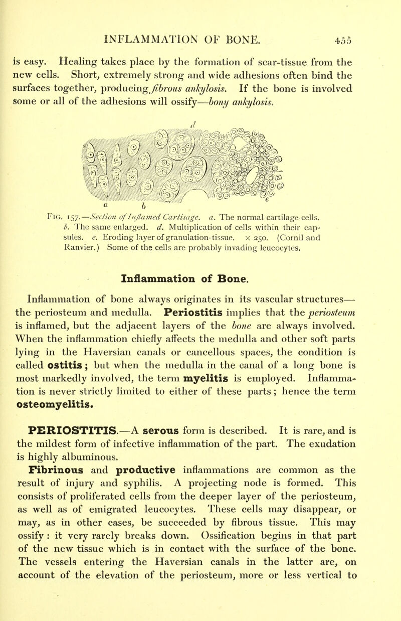 is easy. Healing takes place by the formation of scar-tissue from the new cells. Short, extremely strong and wide adhesions often bind the surfaces together, producing Jib rous ankylosis. If the bone is involved some or all of the adhesions will ossify—bony ankylosis. b Fig. [57.—Section of I//Jlamed Cartilage, a. The normal cartilage cells. b. The same enlarged, d. Multiplication of cells within their cap- sules, e. Eroding layer of granulation-tissue, x 250. (Cornil and Ranvier.) Some of the cells are probably invading leucocytes. Inflammation of Bone. Inflammation of bone always originates in its vascular structures— the periosteum and medulla. Periostitis implies that the jjeriosteimi is inflamed, but the adjacent layers of the bone are always involved. When the inflammation chiefly alfects the medulla and other soft parts lying in the Haversian canals or cancellous spaces, the condition is called ostitis; but when the medulla in the canal of a long bone is most markedly involved, the term myelitis is employed. Inflamma- tion is never strictly limited to either of these parts; hence the term osteomyelitis. PERIOSTITIS.—A serous form is described. It is rare, and is the mildest form of infective inflammation of the part. The exudation is highly albuminous. Fibrinous and productive inflammations are common as the result of injury and syphilis. A projecting node is formed. This consists of proliferated cells from the deeper layer of the periosteum, as well as of emigrated leucocytes. These cells may disappear, or may, as in other cases, be succeeded by fibrous tissue. This may ossify : it very rarely breaks down. Ossification begins in that part of the new tissue which is in contact with the surface of the bone. The vessels entering the Haversian canals in the latter are, on account of the elevation of the periosteum, more or less vertical to