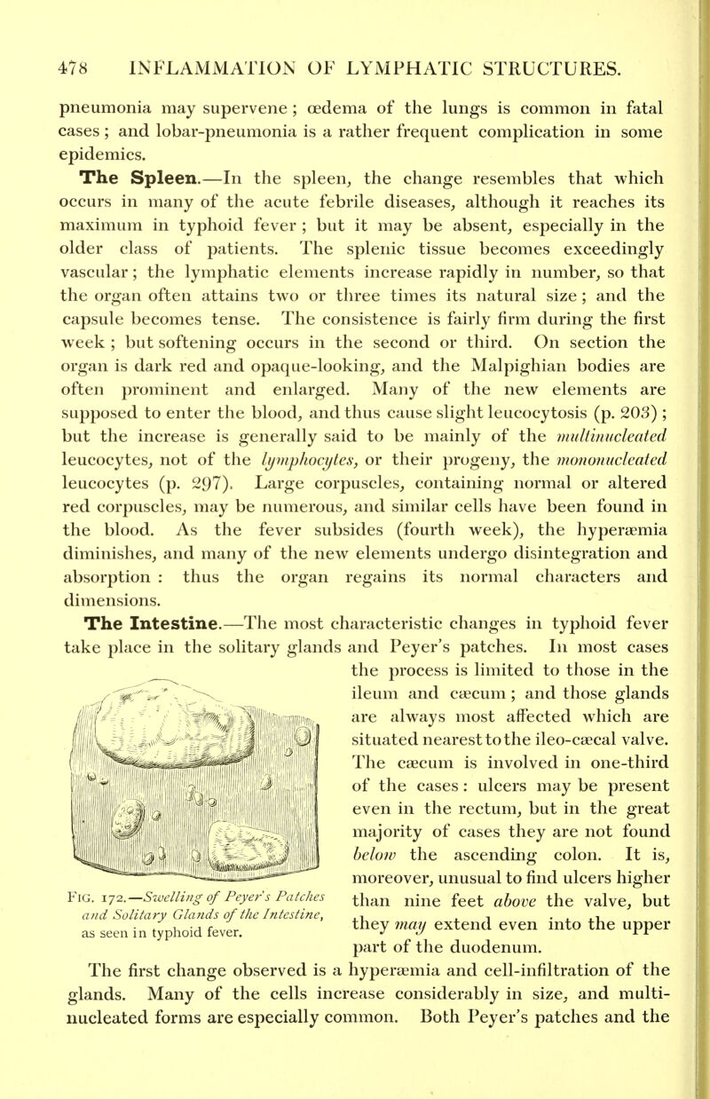 pneumonia may supervene ; oedema of the lungs is common in fatal cases; and lobar-pneumonia is a rather frequent complication in some epidemics. The Spleen.—In the spleen^ the change resembles that which occurs in many of the acute febrile diseases, although it reaches its maximum in typhoid fever ; but it may be absent, especially in the older class of patients. The splenic tissue becomes exceedingly vascular; the lymphatic elements increase rapidly in number, so that the organ often attains two or three times its natural size; and the capsule becomes tense. The consistence is fairly firm during the first week ; but softening occurs in the second or third. On section the organ is dark red and opaque-looking, and the Malpighian bodies are often prominent and enlarged. Many of the new elements are supposed to enter the blood, and thus cause slight leucocytosis (p. 203) ; but the increase is generally said to be mainly of the muliinucleatecl leucocytes, not of the lympliocyles, or their progeny, the mononucleated leucocytes (p. 297). Large corpuscles, containing normal or altered red corpuscles, may be numerous, and similar cells have been found in the blood. As the fever subsides (fourth week), the hyperaemia diminishes, and many of the new elements undergo disintegration and absorption : thus the organ regains its normal characters and dimensions. The Intestine.—The most characteristic changes in typhoid fever take place in the solitary glands and Peyer's patches. In most cases the process is limited to those in the ileum and caecum; and those glands are always most affected which are situated nearest to the ileo-caecal valve. The caecum is involved in one-third of the cases: ulcers may be present even in the rectum, but in the great majority of cases they are not found belon) the ascending colon. It is, moreover, unusual to find ulcers higher than nine feet above the valve, but they mai/ extend even into the upper part of the duodenum, l lie hrst cliange oDservea is a hyperaemia and cell-infiltration of the glands. Many of the cells increase considerably in size, and multi- nucleated forms are especially common. Both Peyer's patches and the Fig. 172.—Swelling of Peyer's Patches a>id Solitary Gla?ids of the Intestine, as seen in typhoid fever.