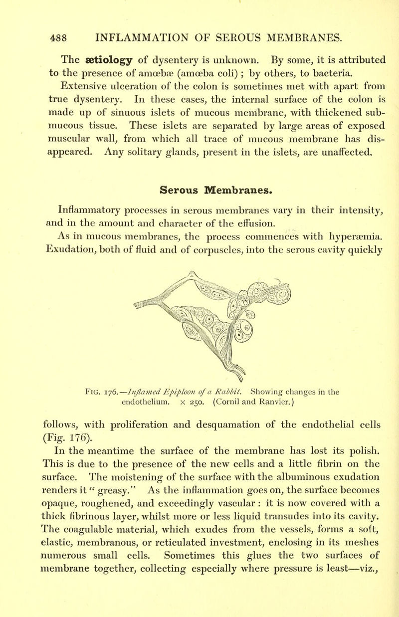 The aetiology of dysentery is unknown. By some^ it is attributed to the presence of amoebae (amoeba coli) ; by others^ to bacteria. Extensive ulceration of the colon is sometimes met with apart from true dysentery. In these cases^ the internal surface of the colon is made up of sinuous islets of mucous membrane, with thickened sub- mucous tissue. These islets are separated by large areas of exposed muscular wall, from which all trace of mucous membrane has dis- appeared. Any solitary glands, present in the islets, are unaffected. Serous Membranes. Inflammatory processes in serous membranes vary in their intensity, and in the amount and character of the effusion. As in mucous membranes, the process commences with hyperaemia. Exudation, both of fluid and of corpuscles, into the serous cavity quickly Fig, 176.—Inflamed Epiploon of a Rabbit. Showing changes in the endothelium, x 250. (Cornil and Ranvier.) follows, with proliferation and desquamation of the endothelial cells (Fig. 176). In the meantime the surface of the membrane has lost its polish. This is due to the presence of the new cells and a little fibrin on the surface. The moistening of the surface with the albuminous exudation renders itgreasy. As the inflammation goes on, the surface becomes opaque, roughened, and exceedingly vascular ; it is now covered with a thick fibrinous layer, whilst more or less liquid transudes into its cavity. The coagulable material, which exudes from the vessels, forms a soft, elastic, membranous, or reticulated investment, enclosing in its meshes numerous small cells. Sometimes this glues the two surfaces of membrane together, collecting especially where pressure is least—viz..