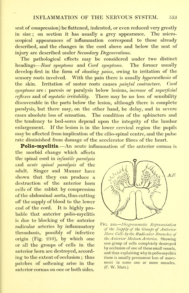 seat of compression) be flattened, indented, or even reduced very greatly in size ; on section it has usually a grey appearance. The micro- scopical appearances of inflammation correspond to those already described, and the changes in the cord above and below the seat of injury are described under Secondary Degenerations. The pathological effects may be considered under two distinct headings—Root symptoms and Cord symptoms. The former usually develop first in the form of shooting pains, owing to irritation of the sensory roots involved. With the pain there is usually hyperaesthesia of the skin. Irritation of motor roots causes painful contracture. Cord symptoms are : paresis or paralysis below lesions, increase of superficial rejiexes and of 7nyotatic irritability. There may be no loss of sensibility discoverable in the parts below the lesion, although there is complete paralysis, but there may, on the other hand, be delay, and in severe cases absolute loss of sensation. The condition of the sphincters and the tendency to bed-sores depend upon the integrity of the lumbar enlargement. If the lesion is in the lower cervical region the pupils may be affected from implication of the cilio-spinal centre, and the pulse rate diminished from damage of the accelerator fibres of the heart. Polio-myelitis.—An acute inflammation of the anterior cornua is the morbid change which affects the spinal cord in in fantile pai'alysis and acute sjnnal paralysis of the adult. Singer and Munzer have shown that they can produce a destruction of the anterior horn cells of the rabbit by compression of the abdominal aorta, thus cutting off the supply of blood to the lower end of the cord. It is highly pro- bable that anterior polio-myelitis is due to blocking of the anterior radicular arteries by inflammatory thrombosis, possibly of infective origin (Fig. 210), by which one or all the groups of cells in the anterior horn are destroyed, accord- ing to the extent of occlusion ; thus patches of softening arise in the anterior cornua on one or both sides. Fig. 2IO.—DiagraiiiDiatic Represeniaiioii of the Supply of the Groups of Anterior Horn Cells by the Radicular Bi'anches of the Antcrior Medlan A rteries. Showing one group of cells completely destroyed by occlusion of one of these small vessels, and thus explaining why in polio-myelitis there is usually permanent loss of move- ment in some one or more muscles. (F. W. Mott.)