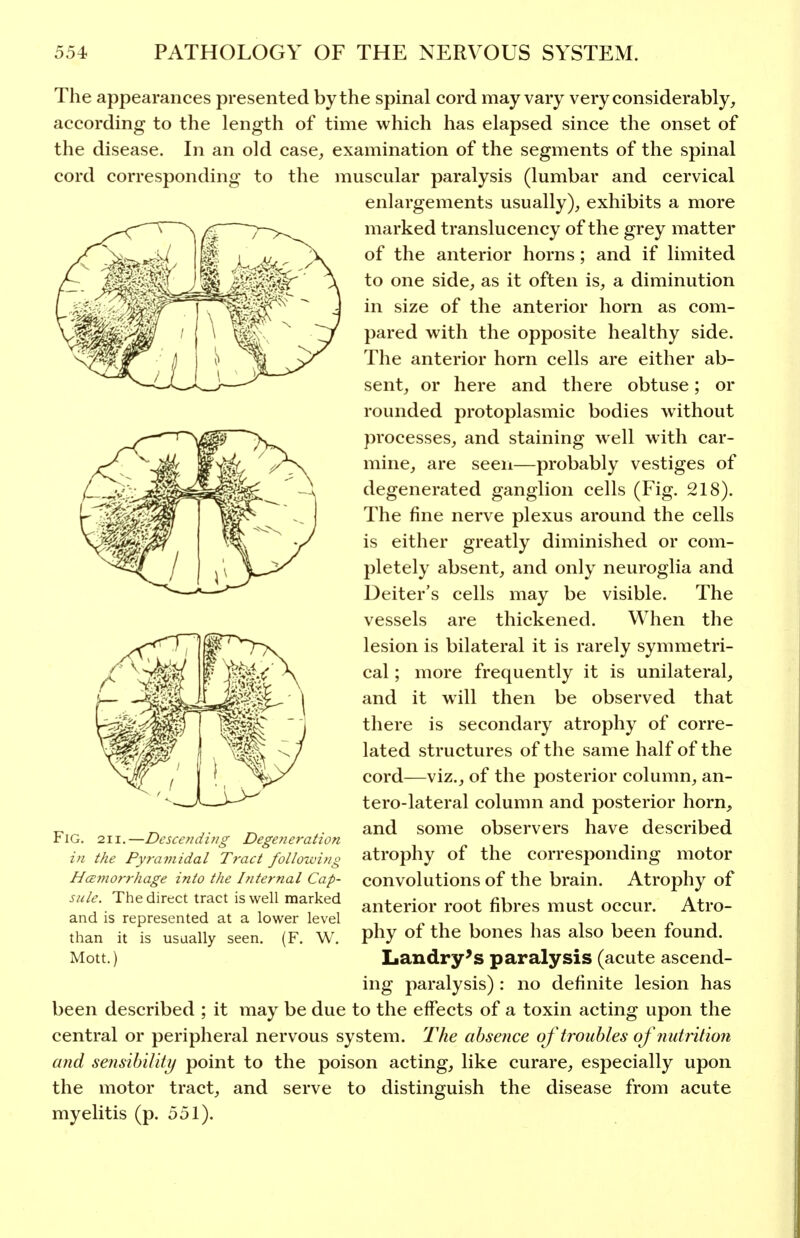 The appearances presented by the spinal cord may vary very considerably, according to the length of time which has elapsed since the onset of the disease. In an old case, examination of the segments of the spinal cord corresponding to the muscular paralysis (lumbar and cervical enlargements usually), exhibits a more marked translucency of the grey matter of the anterior horns; and if limited to one side, as it often is, a diminution in size of the anterior horn as com- pared with the opposite healthy side. The anterior horn cells are either ab- sent, or here and there obtuse; or rounded protoplasmic bodies without processes, and staining well with car- mine, are seen—probably vestiges of degenerated ganglion cells (Fig. 218). The fine nerve plexus around the cells is either greatly diminished or com- pletely absent, and only neuroglia and Deiter's cells may be visible. The vessels are thickened. When the lesion is bilateral it is rarely symmetri- cal ; more frequently it is unilateral, and it will then be observed that there is secondary atrophy of corre- lated structures of the same half of the cord—viz., of the posterior column, an- terolateral column and posterior horn, and some observers have described atrophy of the corresponding motor convolutions of the brain. Atrophy of anterior root fibres must occur. Atro- phy of the bones has also been found. Landry's paralysis (acute ascend- ing paralysis): no definite lesion has been described ; it may be due to the effects of a toxin acting upon the central or peripheral nervous system. The absence of troubles of nutrition and sensibiliti/ point to the poison acting, like curare, especially upon the motor tract, and serve to distinguish the disease from acute myelitis (p. 551). Fig. 211.—Dcscefiding Degeneration in the Pyramidal Tract following HcBtnorrhage into the Internal Cap- sule. The direct tract is well marked and is represented at a lower level than it is usually seen. (F. W. Mott.)