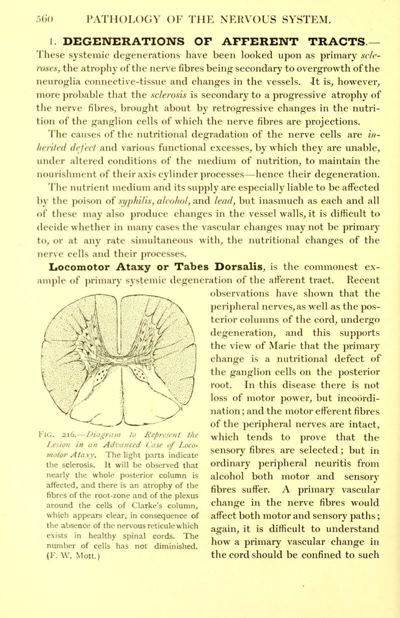 1. DEGE]>n:RATIONS OF AFFERENT TRACTS — These systemic degenerations have been looked upon as primary scle- roses, the atropliy of the nerve fibres being secondary to overgrowth of the neurogha connective-tissue and changes in the vessels. -It is, however, more probable that the sclerosis is secondary to a progressive atrophy of the nerve fibres, brought about by retrogressive changes in the nutri- tion of tlie ganglion cells of which the nerve fibres are projections. The causes of the nutritional degradation of the nerve cells are in- licrifcd defect and various functional excesses, by which they are unable, under altered conditions of the medium of nutrition, to maintain the nourishment of their axis cylinder processes—hence their degeneration. The mitrient medium and its supply are especially liable to be affected by tlie poison of sijphUis, alcohol, and lead, but inasmuch as each and all of these may also produce changes in the vessel walls, it is difficult to decide whether in many cases the vascular changes may not be primary to, or at any rate sinudtaneous with, the nutritional changes of the nerve cells aiul their processes. Locomotor Ataxy or Tabes Dorsalis, is the commonest ex- amj)le of ])rimary systemic degeneration of the afferent tract. Recent —^ ^ _ observations have shown that the })eripheral nerves, as well as the pos- terior columns of the cord, undergo degeneration, and this supports the view of Marie that the primary change is a nutritional defect of the ganglion cells on the posterior root. In this disease there is not loss of motor power, but incoordi- nation ; and the motor efferent fibres of the peripheral nerves are intact, which tends to prove that the sensory fibres are selected; but in ordinary peripheral neuritis from alcohol both motor and sensory fibres suffer. A primary vascular change in the nerve fibres would affect both motor and sensory paths; again, it is difficult to understand how a primary vascular change in the cord should be confined to such KiG. 216.—DiagriiDi to Represent the Lesion in an Advanced Case of Loco- motor Ataxy. The light parts indicate the sclerosis. It will be observed that nearly the whole posterior column is affected, and there is an atrophy of the fibres of the root-zone and of the plexus around the cells of Clarke's column, which appears clear, in consequence of the absence of the nervous reticule which exists in healthy spinal cords. The number of cells has not diminished. (F. W. Mott.)