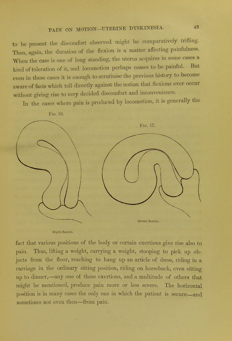 to be present the discomfort observed might be comparatively trifling. Then, again, the dm-ation of the flexion is a matter affecting painfulness. When the case is one of long standing, the uterus acquires in some cases a kind of toleration of it, and locomotion perhaps ceases to be painful. But even in these cases it is enough to scrutinise the previous history to become aware of facts which tell directly against the notion that flexions ever occur without giving rise to very decided discomfort and inconvenience. In the cases where pain is produced by locomotion, it is generally the Fig. 16. Fig. 17. Severe flexion. Blight flexion. fact that various positions of the body or certain exertions give rise also to pain. Thus, lifting a weight, carrying a weight, stooping to pick up ob- jects from the floor, reaching to hang up an article of dress, riding in a carriage in the ordinary sitting position, riding on horseback, even sitting up to dinner,—any one of these exertions, and a multitude of others that might be mentioned, produce pain more or less severe. The horizontal position is in many cases the only one in which the patient is secure and sometimes not even then—from pain.