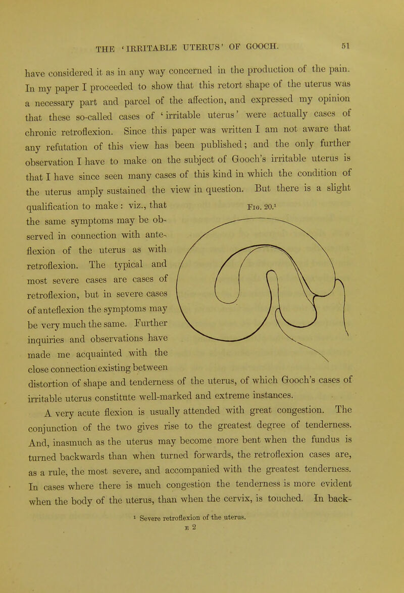THE 'IRRITABLE UTERUS' OF GOOCH. have considered it as in any way concerned in the production of the pain. In my paper I proceeded to show that this retort shape of the uterus was a necessary part and parcel of the affection, and expressed my opinion that these so-called cases of 'irritable uterus' were actually cases of chronic retroflexion. Since this paper was written I am not aware that any refutation of this view has been published; and the only further observation I have to make on the subject of Gooch's irritable uterus is that I have since seen many cases of this kind in which the condition of the uterus amply sustained the view in question. But there is a slight qualification to make : viz., that Fig. 20.1 the same symptoms may be ob- served in connection with ante-. flexion of the uterus as with retroflexion. The typical and most severe cases are cases of retroflexion, but in severe case-s of anteflexion the symptoms may be very much the same. Further inquiries and observations have made me acquainted with the close connection existing between distortion of shape and tenderness of the uterus, of which Gooch's cases of irritable uterus constitute well-marked and extreme instances. A very acute flexion is usually attended with great congestion. The conjunction of the two gives rise to the greatest degree of tenderness. And, inasmuch as the uterus may become more bent when the fundus is turned backwards than when turned forwards, the retroflexion cases are, as a rule, the most severe, and accompanied with the greatest tenderness. In cases where there is much congestion the tenderness is more evident when the body of the uterus, than when the cervix, is touched. In back- ^ Severe retroflexion of the uterus. E 2