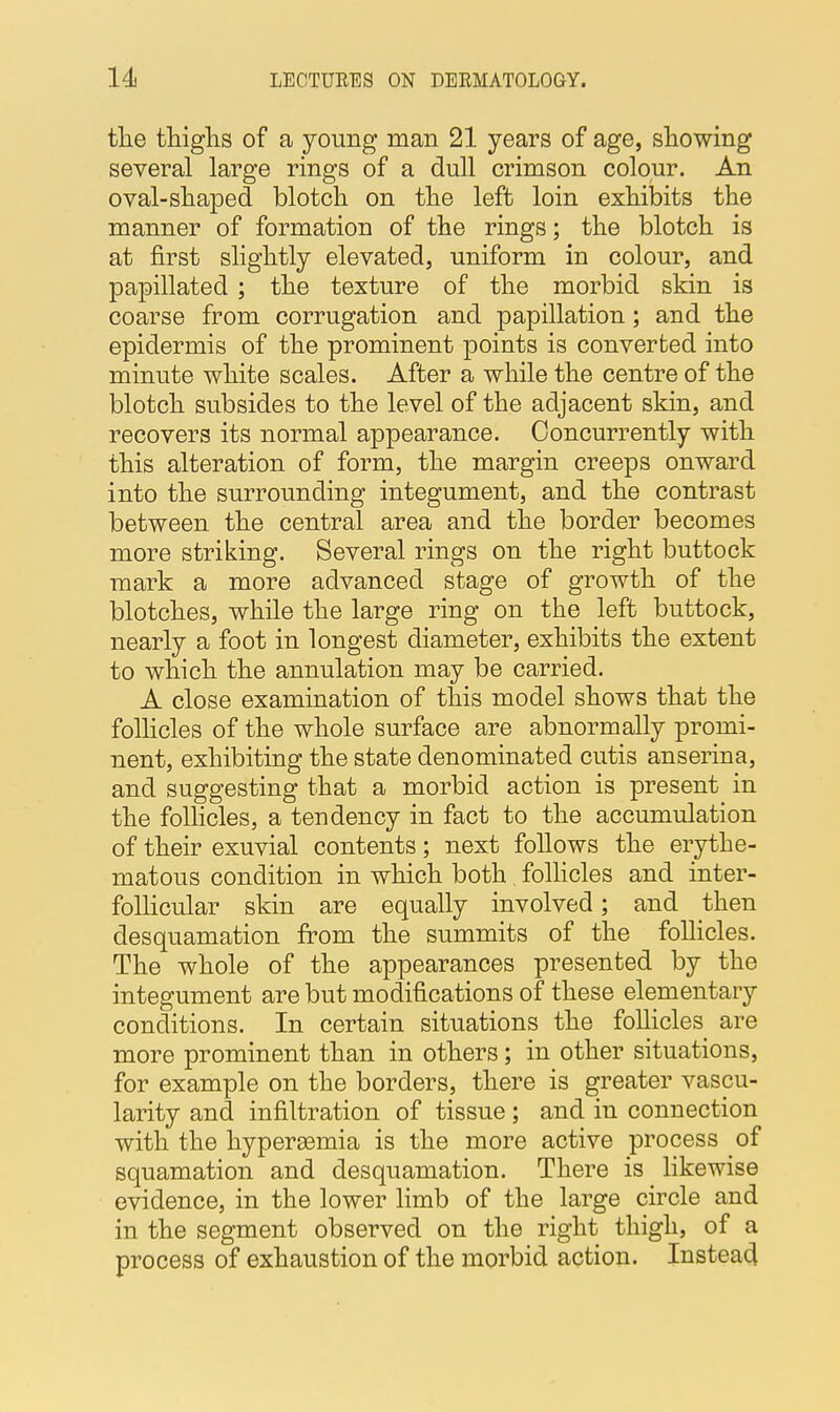 the thighs of a young man 21 years of age, showing several large rings of a dull crimson colour. An oval-shaped blotch on the left loin exhibits the manner of formation of the rings; the blotch is at first slightly elevated, uniform in colour, and papillated ; the texture of the morbid skin is coarse from corrugation and papulation; and the epidermis of the prominent points is converted into minute white scales. After a while the centre of the blotch subsides to the level of the adjacent skin, and recovers its normal appearance. Concurrently with this alteration of form, the margin creeps onward into the surrounding integument, and the contrast between the central area and the border becomes more striking. Several rings on the right buttock mark a more advanced stage of growth of the blotches, while the large ring on the left buttock, nearly a foot in longest diameter, exhibits the extent to which the annulation may be carried. A close examination of this model shows that the follicles of the whole surface are abnormally promi- nent, exhibiting the state denominated cutis anserina, and suggesting that a morbid action is present in the follicles, a tendency in fact to the accumulation of their exuvial contents; next follows the erythe- matous condition in which both follicles and inter- follicular skin are equally involved; and then desquamation from the summits of the follicles. The whole of the appearances presented by the integument are but modifications of these elementary conditions. In certain situations the follicles are more prominent than in others; in other situations, for example on the borders, there is greater vascu- larity and infiltration of tissue; and in connection with the hyperemia is the more active process of squamation and desquamation. There is likewise evidence, in the lower limb of the large circle and in the segment observed on the right thigh, of a process of exhaustion of the morbid action. Instead