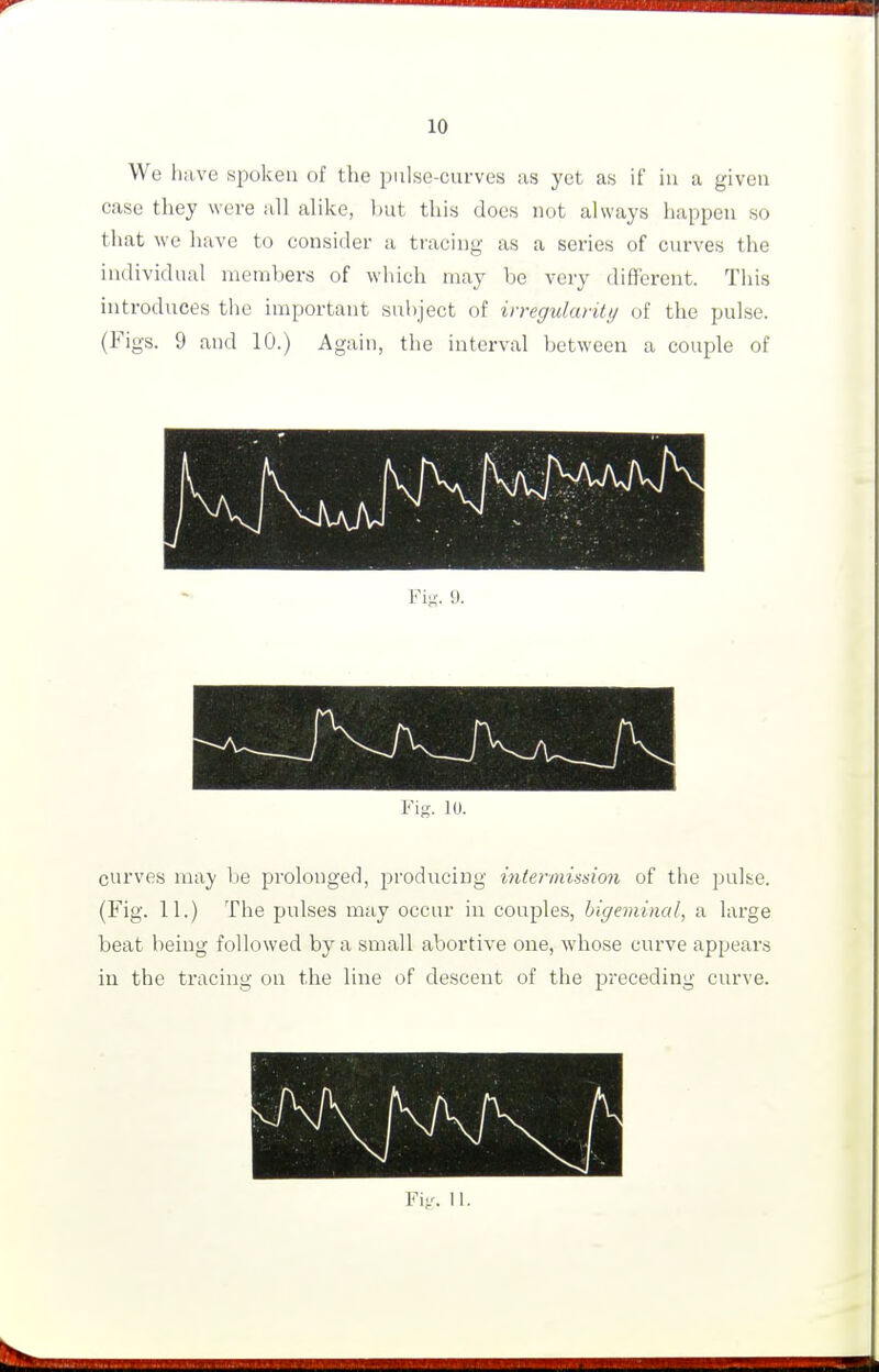 We have spoken of the pulse-curves as yet as if iu a given case they were all alike, but this does not always happen so that we have to consider a tracing as a series of curves the individual members of which may be very different. This introduces the important subject of irregularily of the pulse. (Figs. 9 and 10.) Again, the interval between a couple of Fig. 10. curves may be prolonged, producing intermission of the pulse. (Fig. 11.) The pulses may occur iu couples, bigeminal, a large beat being followed by a small abortive one, whose curve appears in the tracing on the line of descent of the preceding curve.