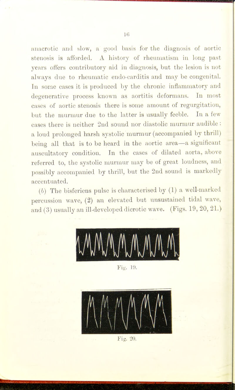 Hiiacrotic ivnd slow, a good basis for the diagnosis of aortic stenosis is afforded. A history of rheumatism in long past years offers contributory aid in diagnosis, but the lesion is not always due to rheumatic endo-carditis and may be congenital. In some cases it is produced by the chronic inflammatory and degenerative process known as aortitis deformans. In most cases of aortic stenosis there is some amount of regurgitation, but the murmur due to the latter is usually feeble. In a few cases there is neither 2nd sound nor diastolic murmur audible : a loud prolonged harsh systolic murmur (accompanied by thrill) being all that is to be heard in the aortic area—a significant auscultatory condition. In the cases of dilated aorta, above referred to, the systolic murmur may be of great loudness, and possibly accompanied by thrill, but the 2nd sound is markedly accentuated. (6) The bisferiens pulse is characterised by (1) a well-marked percussion wave, (2) an elevated but unsustained tidal wave, and (3) usually an ill-developed dicrotic wave. (Figs. 19, 20, 21.)
