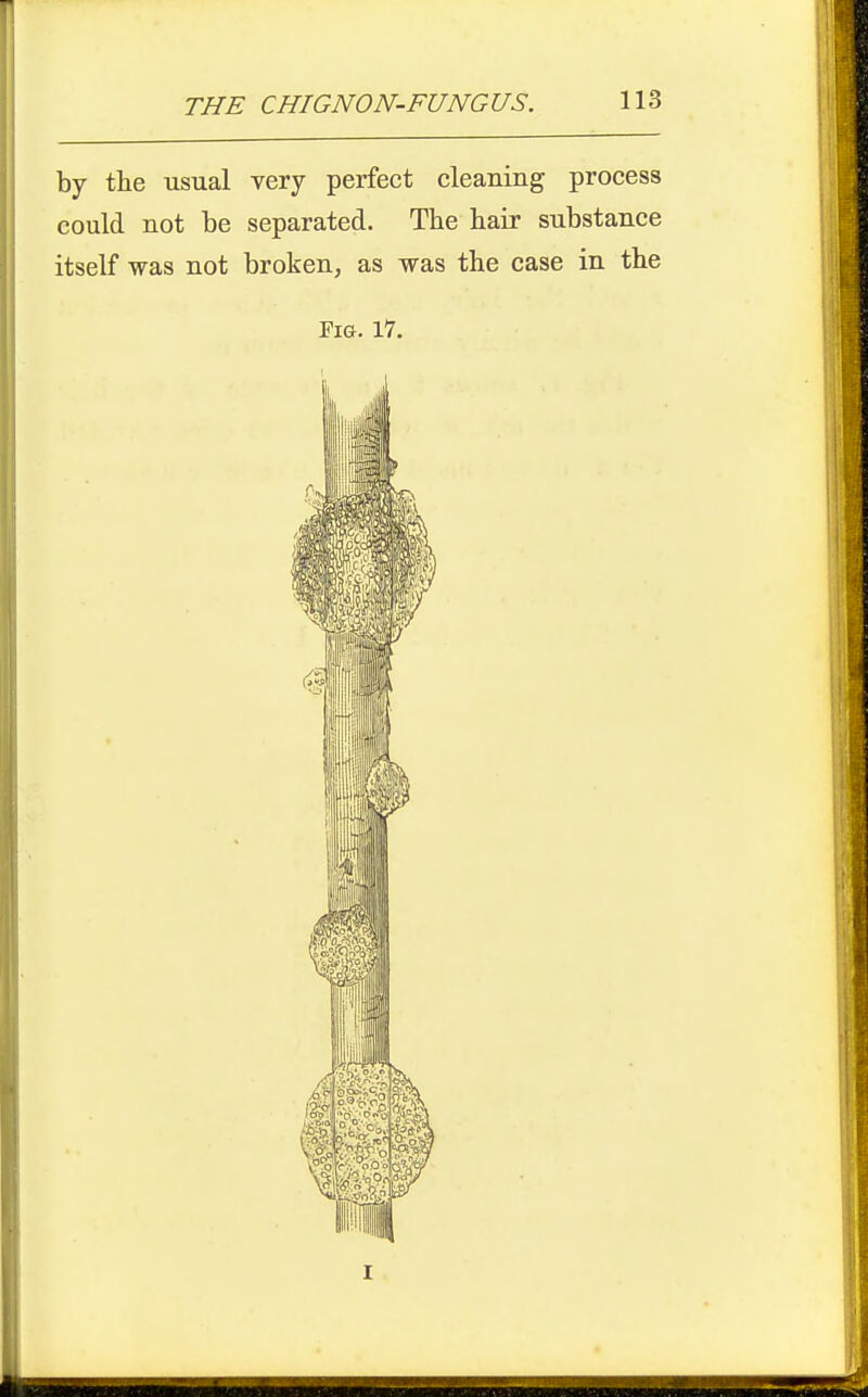 by the usual very perfect cleaning process could not be separated. The hair substance itself was not broken, as was the case in the