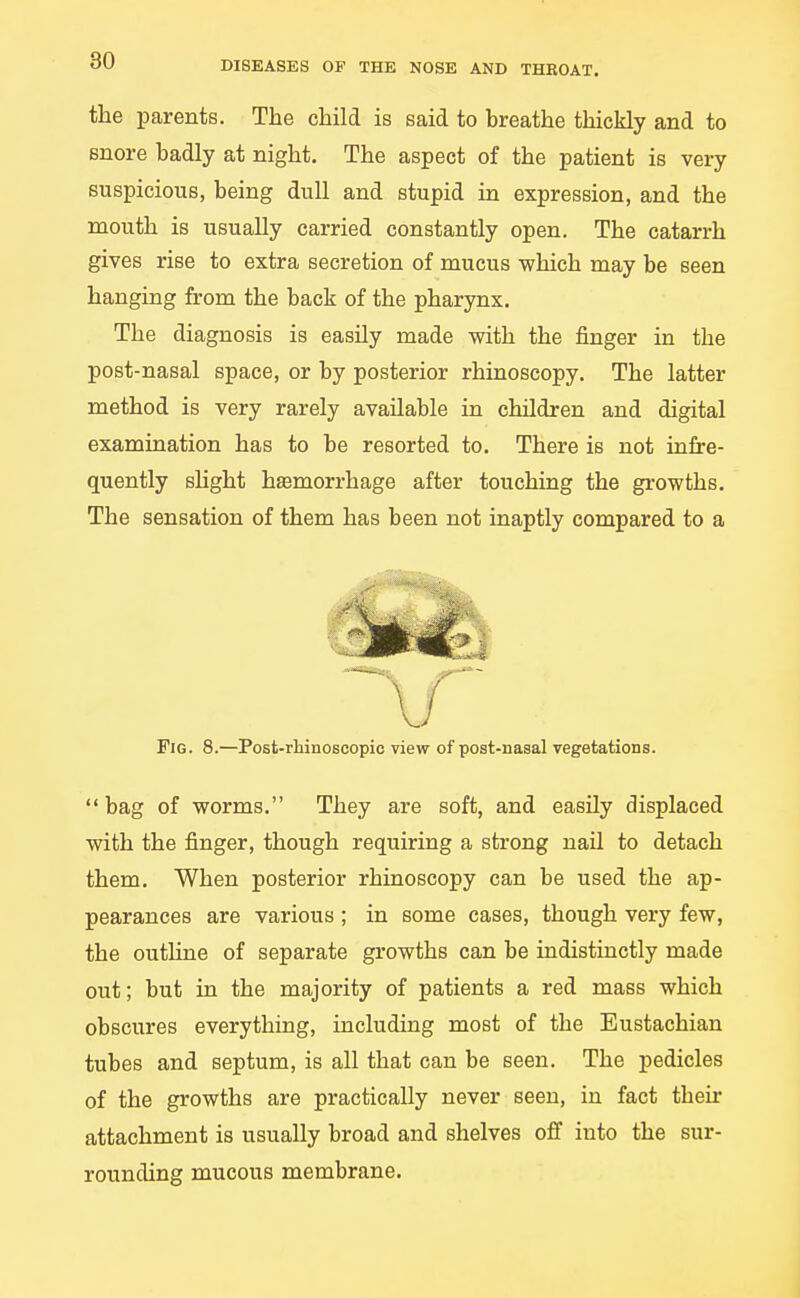 the parents. The child is said to breathe thickly and to snore badly at night. The aspect of the patient is very suspicious, being dull and stupid in expression, and the mouth is usually carried constantly open. The catarrh gives rise to extra secretion of mucus which may be seen hanging from the back of the pharynx. The diagnosis is easUy made with the finger in the post-nasal space, or by posterior rhinoscopy. The latter method is very rarely available in children and digital examination has to be resorted to. There is not infre- quently sHght h£emorrhage after touching the growths. The sensation of them has been not inaptly compared to a Fig. 8.—Post-rhinoscopic view of post-nasal vegetations. bag of worms. They are soft, and easily displaced with the finger, though requiring a strong nail to detach them. When posterior rhinoscopy can be used the ap- pearances are various ; in some cases, though very few, the outline of separate growths can be indistinctly made out; but in the majority of patients a red mass which obscures everything, including most of the Eustachian tubes and septum, is all that can be seen. The pedicles of the growths are practically never seen, in fact their attachment is usually broad and shelves off into the sur- rounding mucous membrane.