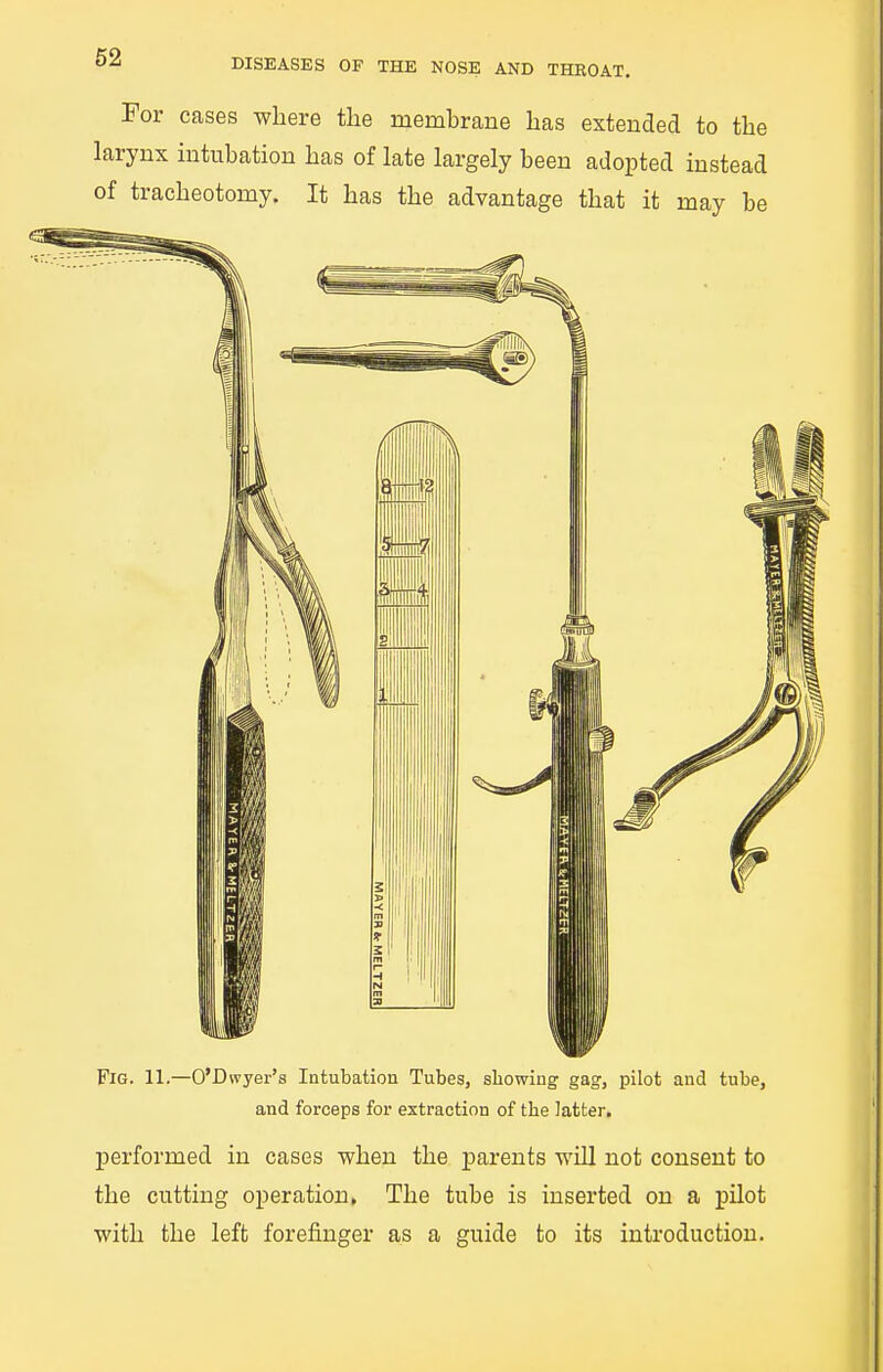 For cases where the membrane has extended to the larynx intubation has of late largely been adopted instead of tracheotomy. It has the advantage that it may be Fig. 11.—O'Dwyer'a Intubation Tubes, showing gag, pilot and tube, and forceps for extraction of tbe latter. performed in cases when the parents will not consent to the cutting operation. The tube is inserted on a pilot with the left forefinger as a guide to its introduction.