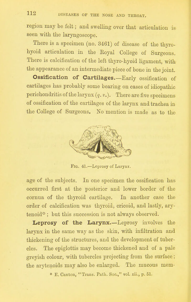 region may be felt; and swelling over that articulation is- seen with the laryngoscope. There is a specimen (no. 3461) of disease of the thyro- hyoid articulation in the Eoyal College of Surgeons. There is calcification of the left thyro-hyoid Hgament, with the appearance of an intermediate piece of bone in the joint. Ossification of Cartilages.—Early ossification of cartilages has probably some bearing on cases of idiopathic perichondritis of the larynx (q. v,). There are five specimens of ossification of the cartilages of the larynx and trachea in the College of Surgeons. No mention is made as to the age of the subjects. In one specimen the ossification has occurred first at the posterior and lower border of the cornua of the thyroid cartilage. In another case the order of calcification was thyroid; cricoid, and lastly, ary- tenoid'''; but this succession is not always observed. Leprosy of the Larynx.—Leprosy involves the larynx in the same way as the skin, with infiltration and thickening of the structures, and the development of tuber- cles. The epiglottis may become thickened and of a pale greyish colour, with tubercles projecting fi-om the surface; the arytenoids may also be enlarged. The mucous mem- Pig. 41.—Leprosy of Larynx.