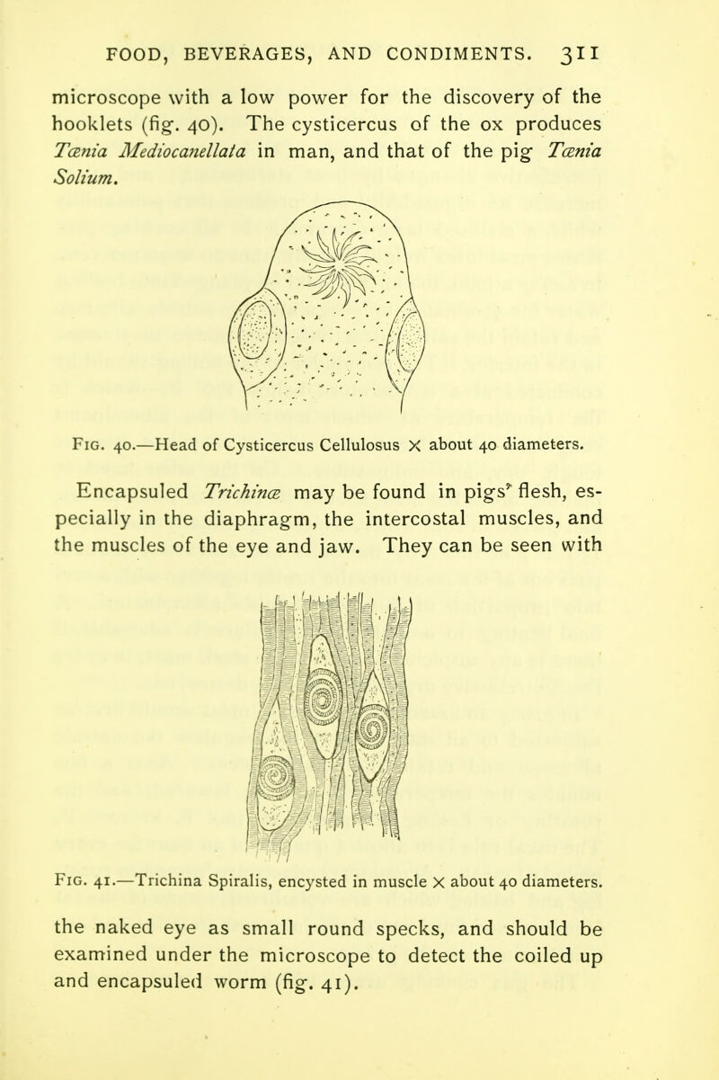 microscope with a low power for the discovery of the hooklets (fig. 40). The cysticercus of the ox produces Tcenia Medioca?iellata in man, and that of the pig Tcenia Solium. Fig. 40.—Head of Cysticercus Cellulosus X about 40 diameters. Encapsuled Trichina may be found in pigs* flesh, es- pecially in the diaphragm, the intercostal muscles, and the muscles of the eye and jaw. They can be seen with Hffi Fig. 41.—Trichina Spiralis, encysted in muscle X about 40 diameters. the naked eye as small round specks, and should be examined under the microscope to detect the coiled up and encapsuled worm (fig. 41).