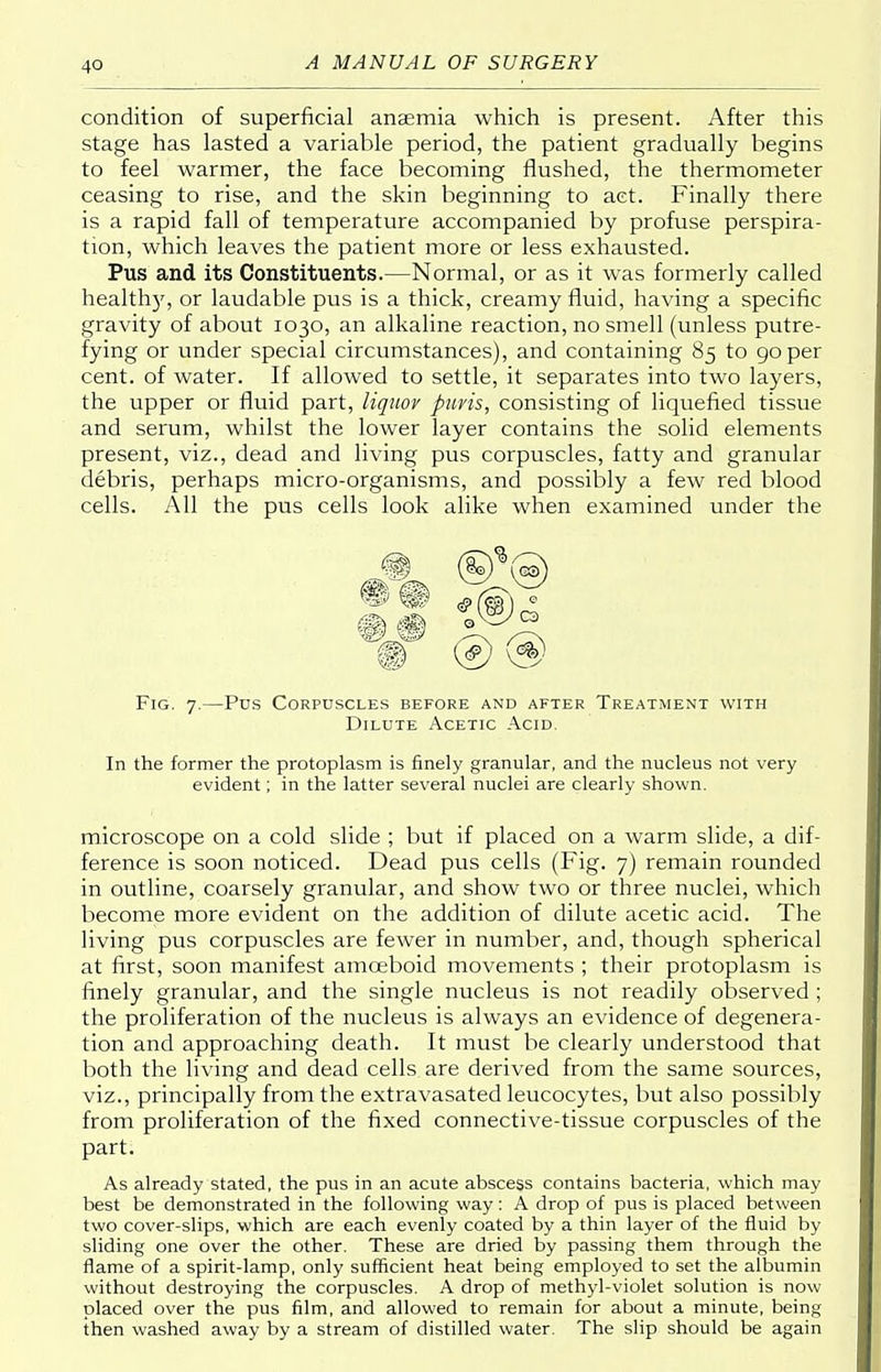 condition of superficial anaemia which is present. After this stage has lasted a variable period, the patient gradually begins to feel warmer, the face becoming flushed, the thermometer ceasing to rise, and the skin beginning to act. Finally there is a rapid fall of temperature accompanied by profuse perspira- tion, which leaves the patient more or less exhausted. Pus and its Constituents.—Normal, or as it was formerly called health}', or laudable pus is a thick, creamy fluid, having a specific gravity of about 1030, an alkaline reaction, no smell (unless putre- fying or under special circumstances), and containing 85 to 90 per cent, of water. If allowed to settle, it separates into two layers, the upper or fluid part, liquor puvis, consisting of liquefied tissue and serum, whilst the lower layer contains the solid elements present, viz., dead and living pus corpuscles, fatty and granular debris, perhaps micro-organisms, and possibly a few red blood cells. All the pus cells look alike when examined under the @ ®<§> Fig. 7.—Pus Corpuscles before and after Treatment with Dilute Acetic Acid. In the former the protoplasm is finely granular, and the nucleus not very evident; in the latter several nuclei are clearly shown. microscope on a cold slide ; but if placed on a warm slide, a dif- ference is soon noticed. Dead pus cells (Fig. 7) remain rounded in outline, coarsely granular, and show two or three nuclei, which become more evident on the addition of dilute acetic acid. The living pus corpuscles are fewer in number, and, though spherical at first, soon manifest amoeboid movements ; their protoplasm is finely granular, and the single nucleus is not readily observed ; the proliferation of the nucleus is always an evidence of degenera- tion and approaching death. It must be clearly understood that both the living and dead cells are derived from the same sources, viz., principally from the extravasated leucocytes, but also possibly from proliferation of the fixed connective-tissue corpuscles of the part. As already stated, the pus in an acute abscess contains bacteria, which may best be demonstrated in the following way: A drop of pus is placed between two cover-slips, which are each evenly coated by a thin layer of the fluid by sliding one over the other. These are dried by passing them through the flame of a spirit-lamp, only sufficient heat being employed to set the albumin without destroying the corpuscles. A drop of methyl-violet solution is now placed over the pus film, and allowed to remain for about a minute, being then washed away by a stream of distilled water. The slip should be again