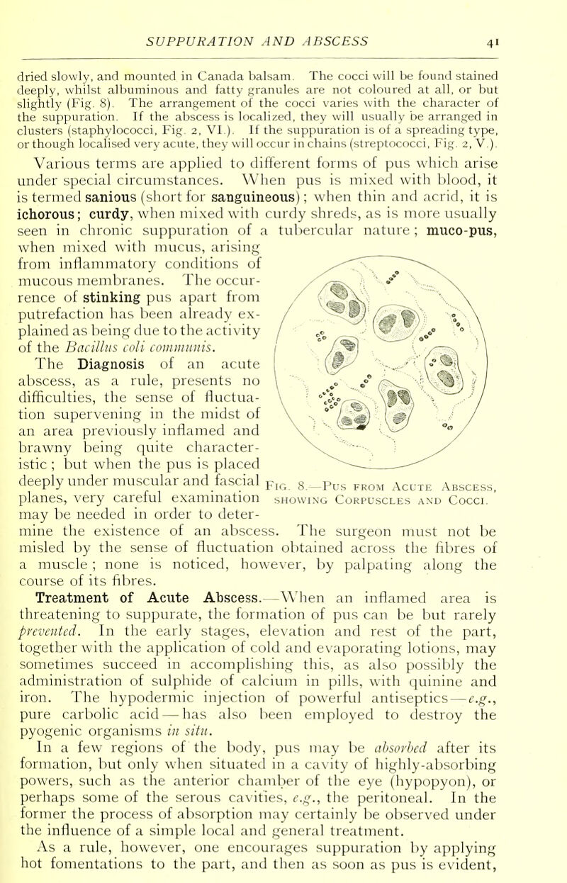dried slowly, and mounted in Canada balsam. The cocci will be found stained deeply, whilst albuminous and fatty granules are not coloured at all, or but slightly (Fig. 8). The arrangement of the cocci varies with the character of the suppuration. If the abscess is localized, they will usually be arranged in clusters (staphylococci, Fig. 2, VI.). If the suppuration is of a spreading type, or though localised very acute, they will occur in chains (streptococci, Fig. 2, V.). Various terms are applied to different forms of pus which arise under special circumstances. When pus is mixed with blood, it is termed sanious (short for sanguineous); when thin and acrid, it is ichorous; curdy, when mixed with curdy shreds, as is more usually seen in chronic suppuration of a tubercular nature ; muco-pus, when mixed with mucus, arising from inflammatory conditions of mucous membranes. The occur- rence of stinking pus apart from putrefaction has been already ex- plained as being due to the activity of the Bacillus coli communis. The Diagnosis of an acute abscess, as a rule, presents no difficulties, the sense of fluctua- tion supervening in the midst of an area previously inflamed and brawny being quite character- istic ; but when the pus is placed deeply under muscular and fascial FlG 8._Pus FR0M AcuTE AbscesSi planes, very careful examination showing Corpuscles and Cocci, may be needed in order to deter- mine the existence of an abscess. The surgeon must not be misled by the sense of fluctuation obtained across the fibres of a muscle ; none is noticed, however, by palpating along the course of its fibres. Treatment of Acute Abscess. -When an inflamed area is threatening to suppurate, the formation of pus can be but rarely prevented. In the early stages, elevation and rest of the part, together with the application of cold and evaporating lotions, may sometimes succeed in accomplishing this, as also possibly the administration of sulphide of calcium in pills, with quinine and iron. The hypodermic injection of powerful antiseptics — e.g., pure carbolic acid — has also been employed to destroy the pyogenic organisms in situ. In a few regions of the body, pus may be absorbed after its formation, but only when situated in a cavity of highly-absorbing powers, such as the anterior chamber of the eye (hypopyon), or perhaps some of the serous cavities, e.g., the peritoneal. In the former the process of absorption may certainly be observed under the influence of a simple local and general treatment. As a rule, however, one encourages suppuration by applying hot fomentations to the part, and then as soon as pus is evident,