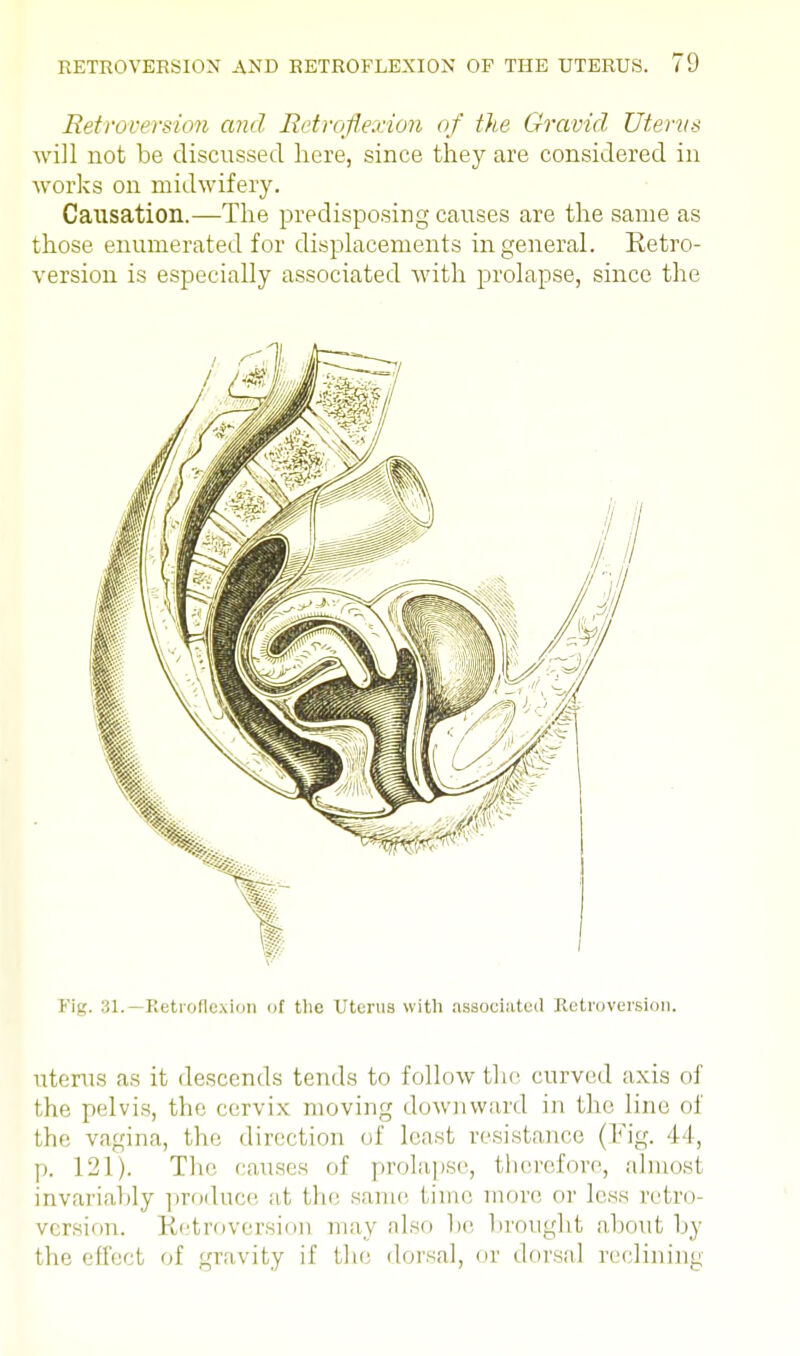 Retroversion and Retroflexion of the Gravid Uterus will not be discussed here, since they are considered in works on midwifery. Causation.—The predisposing causes are the same as those enumerated for displacements in general. Retro- version is especially associated with prolapse, since the Fig. 31.—Retroflexion of the Uterus with associated Retroversion. utems as it descends tends to follow the curved axis of the pelvis, the cervix moving downward in the line of the vagina, the, direction of least resistance (Fig. 44, p. 121). The causes of prolapse, therefore, almost invariably produce at. the same time more or less retro version. Retroversion may also lie brought about by the effect of gravity if the dorsal, or dorsal reclining