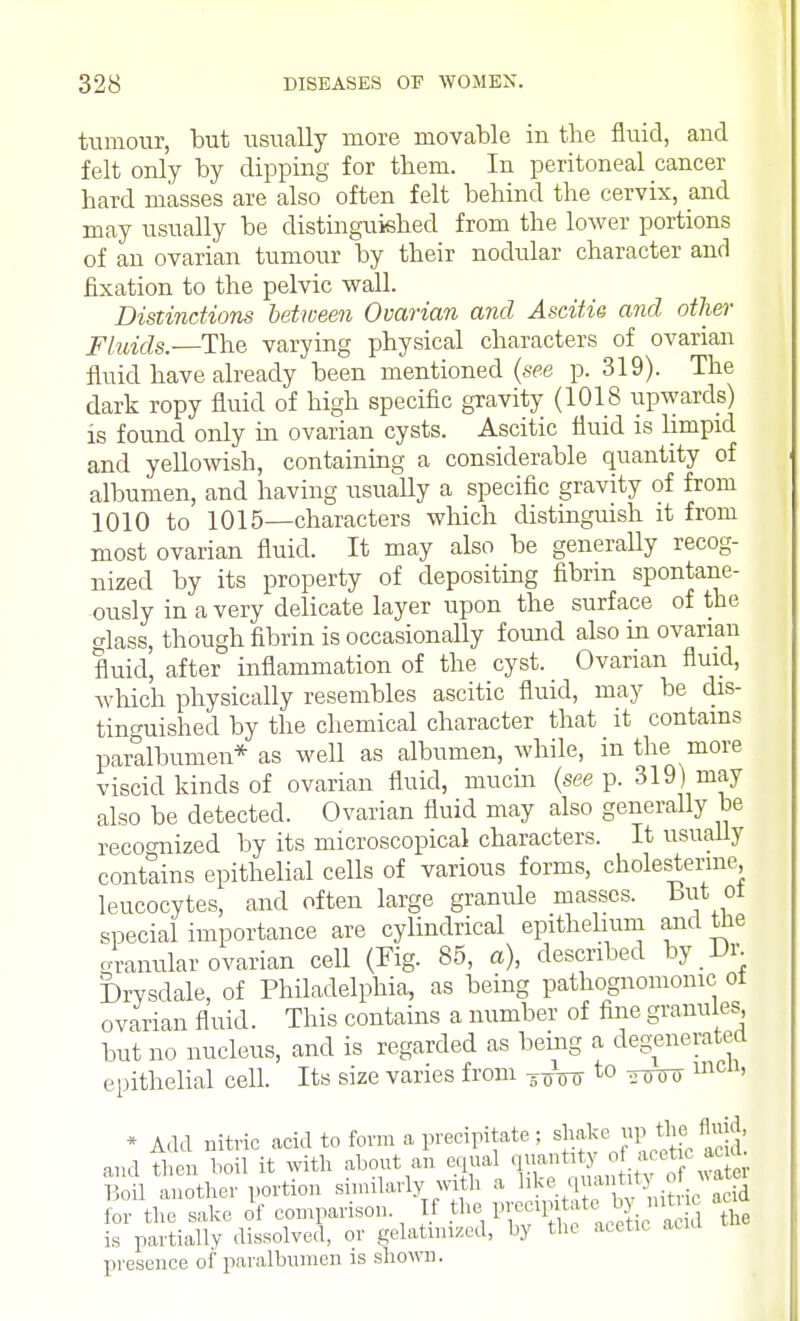 tumour, but usually more movable in the fluid, and felt only by dipping for them. In peritoneal cancer hard masses are also often felt behind the cervix, and may usually be distinguished from the lower portions of an ovarian tumour by their nodular character and fixation to the pelvic wall. Distinctions between Ovarian and Ascitis and other Fluids.—The varying physical characters of ovarian fluid have already been mentioned (see p. 319). The dark ropy fluid of high specific gravity (1018 upwards) is found only in ovarian cysts. Ascitic fluid is limpid and yellowish, containing a considerable quantity of albumen, and having usually a specific gravity of from 1010 to 1015—characters which distinguish it from most ovarian fluid. It may also be generally recog- nized by its property of depositing fibrin spontane- ously in a very delicate layer upon the surface of the glass, though fibrin is occasionally found also in ovarian fluid, after inflammation of the cyst. Ovarian fluid, which physically resembles ascitic fluid, may be dis- tinguished by the chemical character that it contains paralbumen* as well as albumen, while, in the more viscid kinds of ovarian fluid, mucin (seep. 319) may also be detected. Ovarian fluid may also generally be recoo-nized by its microscopical characters. It usually contains epithelial cells of various forms, cholesterme leucocytes, and often large granule masses, tut ol special importance are cylindrical epithelium and tlie granular ovarian cell (Fig. 85, a), described by Dr. Drysdale, of Philadelphia, as being pathognomonic ot ovarian fluid. This contains a number of fine granules but no nucleus, and is regarded as being a degenerated epithelial cell. Its size varies from to men, * Add nitric acid to form a precipitate; shakeJl. the, fluid, and then boil it with about an equal V>»« BoH another portion similarly with a 1 k  - 1> «' * d for the sake of comparison If the precn atate > n is partially dissolved, or gelatinized, by the acetic acid presence of paralbumen is shown.