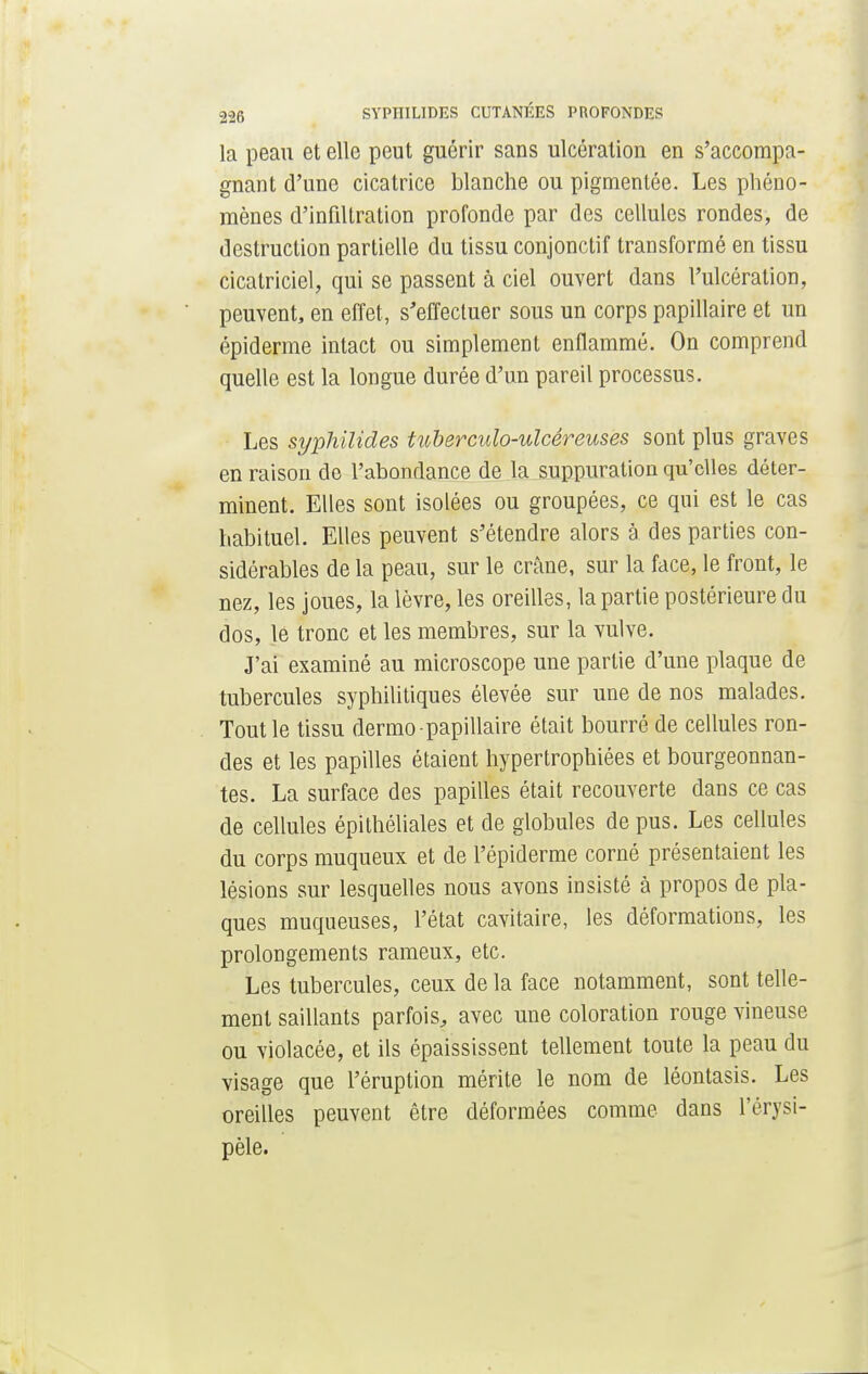 la peau et elle peut guérir sans ulcération en s'accompa- gnant d'une cicatrice blanche ou pigmentée. Les phéno- mènes d'infiltration profonde par des cellules rondes, de destruction partielle du tissu conjonctif transformé en tissu cicatriciel, qui se passent à ciel ouvert dans l'ulcération, peuvent, en effet, s'effectuer sous un corps papillaire et un épidémie intact ou simplement enflammé. On comprend quelle est la longue durée d'un pareil processus. Les syphilides tuberculo-ulcéreuses sont plus graves en raison do l'abondance de la suppuration qu'elles déter- minent. Elles sont isolées ou groupées, ce qui est le cas habituel. Elles peuvent s'étendre alors à des parties con- sidérables de la peau, sur le crâne, sur la face, le front, le nez, les joues, la lèvre, les oreilles, la partie postérieure du dos, le tronc et les membres, sur la vulve. J'ai examiné au microscope une partie d'une plaque de tubercules syphilitiques élevée sur une de nos malades. Tout le tissu dermo papillaire était bourré de cellules ron- des et les papilles étaient hypertrophiées et bourgeonnan- tes. La surface des papilles était recouverte dans ce cas de cellules épithéliales et de globules de pus. Les cellules du corps muqueux et de l'épiderme corné présentaient les lésions sur lesquelles nous avons insisté à propos de pla- ques muqueuses, l'état cavitaire, les déformations, les prolongements rameux, etc. Les tubercules, ceux de la face notamment, sont telle- ment saillants parfois, avec une coloration rouge vineuse ou violacée, et ils épaississent tellement toute la peau du visage que l'éruption mérite le nom de léontasis. Les oreilles peuvent être déformées comme dans l'érysi- pèle.