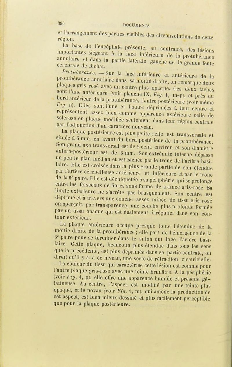 ^arrangement des parties visibles des circonvolutions de cette La base de l'encéphale présente, au contraire, des lésions importantes siégeant à la face inférieure de la pro ubér nce XÏÏZSSSfpartielaté,,ale ~ *VS!ïS Protubérance. -Sur la face inférieure et antérieure de la TU,ai''e dUnS » m0iUé droile> on remarque de sonTrun^nir T Un CenU'e P1US °paque' Ces deux **« sont I une antérieure (voir planche IX, F^. i, m.p) et Drès du bord antérieur de la protubérance, l'autre pUrieuîe (2 même , fS SOnt 1 Une et rautre ^primées à leur centre et représentent assez bien comme apparence extérieure celle de sclérose en plaque modifiée seulement dans leur région centrale par 1 adjonction d'un caractère nouveau. La plaque postérieure est plus petite; elle est transversale et située a 6 mm. en avant du bord postérieur de la protubérance Son grand axe transversal est de 2 cent, environ et son diamètre antéro-postérieur est de 5 mm. Son extrémité interne dépasse un peu le plan médian et estcacbée parle tronc de l'artère basi- lan e. Elle est croisée dans la plus grande partie de son étendue par 1 artère cérébelleuse antérieure et inférieure et par le tronc de la 6° paire. Elle est déchiquetée à sa périphérie qui se prolonge entre les faisceaux de fibres sous forme de traînée gris-rosé Sa limite extérieure ne s'arrête pas brusquement. Son centre est déprimé et a travers une couche assez mince de tissu gris-rosé on aperçoit, par transparence, une couche plus profonde formée par un tissu opaque qui est également irrégulier dans son con- tour extérieur. La plaque antérieure occupe presque toute l'étendue de la moitié droite de la protubérance; elle part de l'émergence de la 5e paire pour se terminer dans le sillon qui loge l'artère basi- laire. Cette plaque, beaucoup plus étendue dans tous les sens que la précédente, est plus déprimée dans sa partie centrale, on dirait qu'il y a, à ce niveau, une sorte de rétraction cicatricielle. ^ La couleur du tissu qui caractérise cette lésion est comme pour l'autre plaque gris-rosé avec une teinte brunâtre, k la périphérie (voir Fig. 4, p), elle ofifre une apparence humide et presque gé- latineuse. Au centre, l'aspect est modifié par une teinte plus opaque, et le noyau ('voir Fig. 1, m), qui amène la production de cet aspect, est bien mieux dessiné et plus facilement perceptible que pour la plaque postérieure.