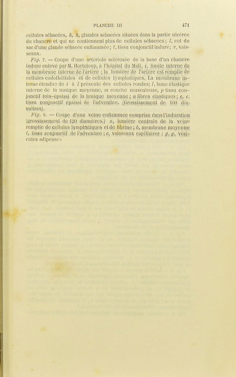 cellules sébacées, h, 11, glandes sébacées situées dans la partie ulcérée du chancre et qui ne contiennent plus de cellules sébacées; l, cul de sac d'une glande sébacée enflammée; t, tissu conjonctif induré; v, vais- seaux. Fi//. 7. — Coupe d'une artériolc sclérosée de la base d'un chancre induré enlevé parM. UqrtQloup. a l'Iiùpilal du .Midi. /, limite interne de la membrane interne (lei l'artère ;la lumière de l'artère est remplie de cellules endothélialcs et de cellules lymphatiques. La membrane In- terne étendus de i kl présente des cellules rondes; l, lame élastique interne de la umique moyenne, m couche musculcusc, p tissu con- jonclif très-épaissi de la tunique moyenne; n libres élastiques; e, e, [issu conjonclir épaissi de l'adventice. (Grossissement de 100 dia- mètres). Fiff. S. — Coupe d'une veine enflammée comprise dansl'induralion (grossissement de 120 diamètres.) a, lumière centrale de la veine remplie de cellules lymplraliques et de fibrine; b, membrane moyenne t, tissu ppnjqnptif de l'adventice ; c, vaisseaux capillaires ; g,gs vési- cules adipeuses
