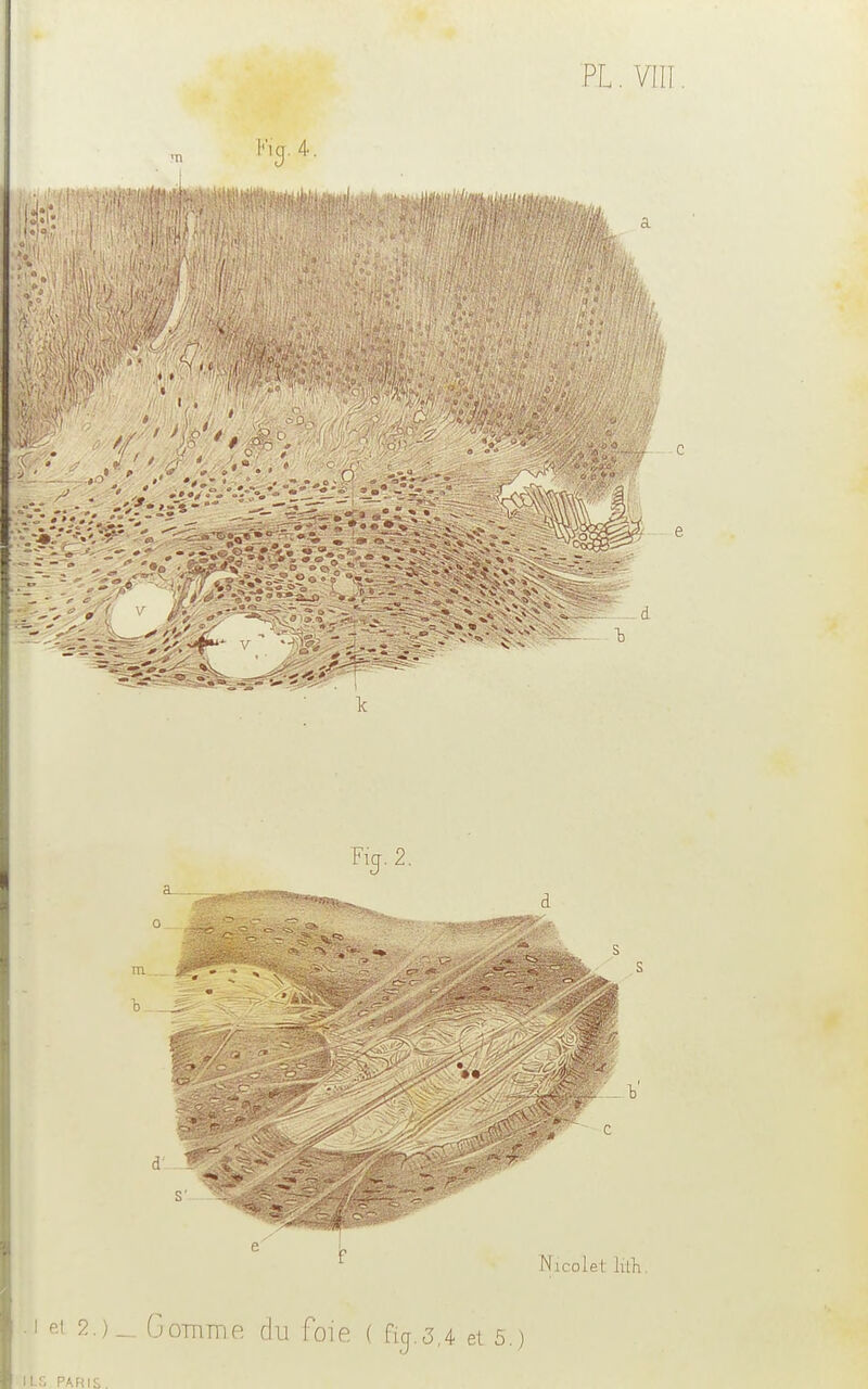 d 1 S ' •-■ e l> t Nicolet lith. • i et 2.)_ Comme du foie ( fij.3,4 et 5.) ILS PARIS.