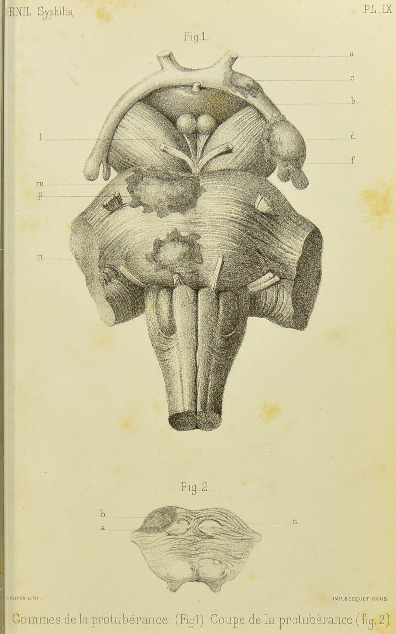 PL.IX Fig.2 b a CI)V€R LITH . IMP.BF.CQUKT PAHIS Gommes de la protubérance (Pïcpl) Coupe de la protubérance (fkj. 2)