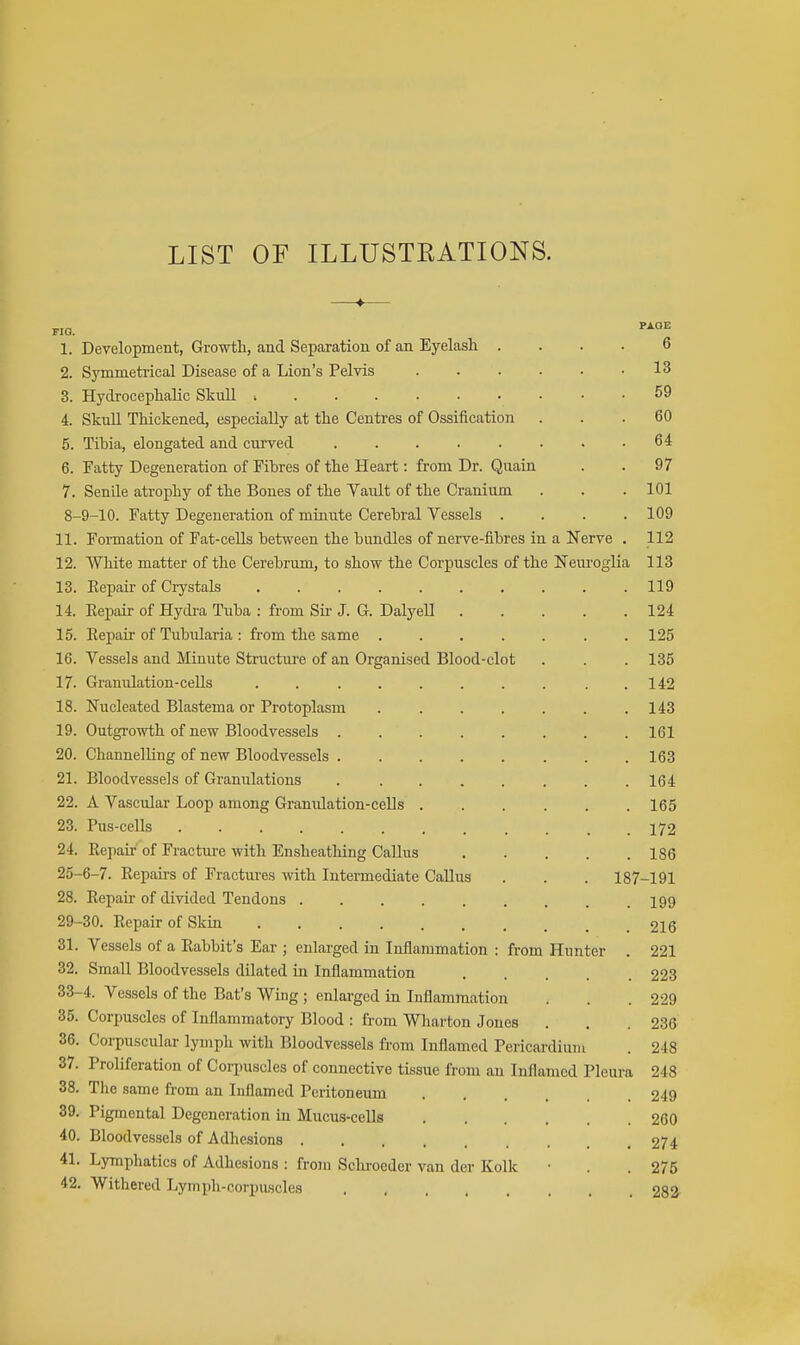 LIST OF ILLUSTEATIONS. FIG. 1. Development, Growth, and Separation of an Eyelash .... 2. Symmetrical Disease of a Lion's Pelvis ...... 3. Hydrocephalic Skull 4. SkuU Thickened, especially at the Centres of Ossification 5. Tibia, elongated and curved 6. Fatty Degeneration of Fibres of the Heart: from Dr. Quain 7. Senile atrophy of the Bones of the Vault of the Cranium 8-9-10. Fatty Degeneration of minute Cerebral Vessels .... 11. Formation of Fat-ceUs between the bundles of nerve-fibres in a Nerve . 12. White matter of the Cerebrum, to show the Corpuscles of the Neuroglia 13. Repair of Crystals ....... 14. Eepair of Hydi-a Tuba : from Su- J. G. Dalyell 15. Repair of Tubvdaria : from the same .... 16. Vessels and Minute Structui-e of an Organised Blood-clot 17. Granulation-cells ....... 18. Nucleated Blastema or Protoplasm .... 19. Outgrowth of new Bloodvessels 20. Channelling of new Bloodvessels ..... 21. Bloodvessels of Granulations ..... 22. A Vascular Loop among Gramdation-cells . 23. Pus-cells 24. Repaii- of Fractm-e with Ensheatliing Callus 25-6-7. Repau-s of Fractures with Intermediate CaUus 28. Repau- of divided Tendons 29-30. Repair of Skin 31. Vessels of a Rabbit's Ear ; enlarged in Inflammation : from 32. Small Bloodvessels dilated in Inflammation 33-4. Vessels of the Bat's Wing ; enlarged in Inflammation 35. Corpuscles of Inflammatory Blood : from Wharton Jones 36. Corpuscular lymph with Bloodvessels from Inflamed Pericar 37. Proliferation of Coii)uscles of connective tissue from an Inflamed Pleura 38. The same from an Inflamed Peritoneum 39. Pigmental Degeneration in Mucus-cells 40. Bloodvessels of Adhesions 41. Lymphatics of Adhesions : from Schrocder van der Kolk 42. Withered Lymph-corpuscles Hunter diuni 6 13 59 60 64 97 101 109 112 113 . 119 . 124 . 125 . 135 . 142 . 143 . 161 . 163 . 164 . 165 . 172 . 186 187-191 . 199 . 216 . 221 . 223 . 229 . 236 . 248 248 249 260 274 275 282