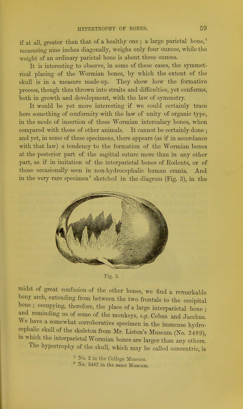 if at all, greater than that of a healthy one ; a large parietal bone/ measuring nine inches diagonally, weighs only four ounces, while the weight of an ordinary parietal bone is about three ounces. It is interesting to observe, in some of these cases, the symmet- rical placing of the Wormian bones, by which the extent of the skull is in a measure made-up. They show how the formative process, though thus thrown into straits and difficulties, yet conforms, both in growth and development, with the law of symmetry. It would be yet more interesting if we could certainly trace here something of conformity with the law of unity of organic type, in the mode of insertion of these Wormian intercalary bones, when, compared with those of other animals. It cannot be certainly done ; and yet, in some of these specimens, there appears (as if in accordance with that law) a tendency to the formation of the Wormian bones at the posterior part of the sagittal suture more than in any other part, as if in imitation of the interparietal bones of Rodents, or of those occasionally seen in non-hydrocephalic human crania. And in the very rare specimen^ sketched in the diagram (Fig. 3), in the Fig. 3. midst of great confusion-of the other bones, we find a remarkable bony arch, extending from between the two frontals to the occipital bone ; occupying, therefore, the place of a large interparietal bone ; and remmdmg us of some of the monkeys, e.g. Cebus and Jacchus. We have a somewhat corroborative specimen in the immense hydro- cephalic skuU of the skeleton from Mr. Liston's Museum (No. 3489), m which the interparietal Wormian bones are larger than any others. The hypertrophy of the skull, which may be called concentric, is ^ No. 2 in the College Museum. ' No. 3487 in the same Museum.