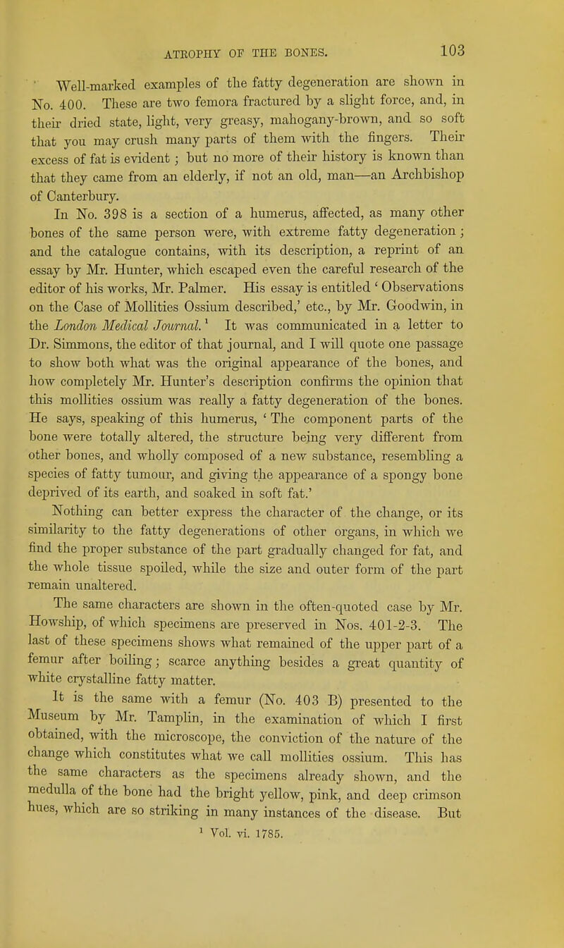Well-marked examples of tlie fatty degeneration are shown in No. 400. These are two femora fractured by a slight force, and, in then- dried state, light, very greasy, mahogany-brown, and so soft that you may crush many parts of them with the fingers. Their excess of fat is evident; but no more of their history is known than that they came from an elderly, if not an old, man—an Archbishop of Canterbury. In No. 398 is a section of a humerus, affected, as many other bones of the same person were, with extreme fatty degeneration; and the catalogue contains, with its description, a reprint of an essay by Mr. Hunter, which escaped even the careful research of the editor of his works, Mr. Palmer. His essay is entitled ' Observations on the Case of Mollities Ossium described,' etc., by Mr. Goodwin, in the London Medical Journal. * It was communicated in a letter to Dr. Simmons, the editor of that journal, and I will quote one passage to show both what was the original appearance of the bones, and how completely Mr. Hunter's description confirms the opinion that this mollities ossium was really a fatty degeneration of the bones. He says, speaking of this humerus, ' The component parts of the bone were totally altered, the structure being very different from other bones, and wholly composed of a new substance, resembling a species of fatty tumour, and giving the appearance of a spongy bone deprived of its earth, and soaked in soft fat.' Nothing can better express the character of the change, or its similarity to the fatty degenerations of other organs, in which we find the proper substance of the part gradually changed for fat, and the whole tissue spoiled, while the size and outer form of the part remain unaltered. The same characters are shown in the often-quoted case by Mr. Howship, of which specimens are preserved in Nos. 401-2-3. The last of these specimens shows what remained of the upper part of a femur after boiling; scarce anything besides a great quantity of white crystalline fatty matter. It is the same with a femur (No. 403 B) presented to the Museum by Mr. Tamplin, in the examination of which I first obtained, with the microscope, the conviction of the nature of the change which constitutes what we call mollities ossium. This has the same characters as the specimens already shown, and the medulla of the bone had the bright yellow, pink, and deep crimson hues, which are so striking in many instances of the disease. But ' Vol. vi. 1785.