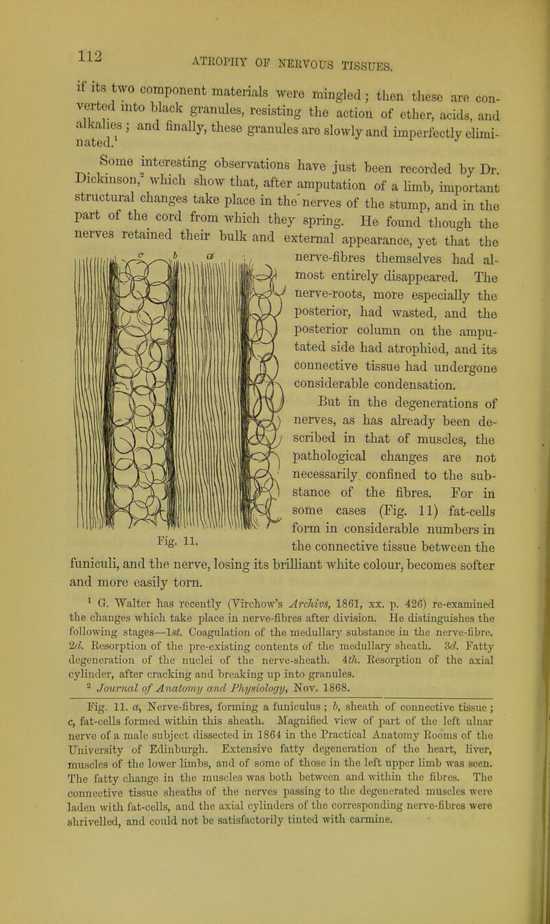 ATROPHY OF NERVOUS TISSUES. If Its two component materials were mingled; then these are con- verted mto black granules, resisting the action of ether, acids, and alkalies; and finally, these granules are slowly and imperfectly elimi- nated. Some interesting observations have just been recorded by Dr Diclanson,- which show that, after amputation of a limb, important structural changes take place in the nerves of the stump, and in the part of the cord from which they spring. He found though the nerves retamed their bulk and external appearance, yet that the *  nerve-fibres themselves had al- most entirely disappeared. The nerve-roots, more especially the posterior, had wasted, and the posterior column on the ampu- tated side had atrophied, and its connective tissue had undergone considerable condensation. But in the degenerations of nerves, as has already been de- scribed in that of muscles, the pathological changes are not necessarily confined to the sub- stance of the fibres. For in some cases (Fig. 11) fat-cells form in considerable numbers in the connective tissue between the funiculi, and the nerve, losing its brilliant white colour, becomes softer and more easily torn. ^ G. Walter has recently (Virchow's Archivs, 1861, xx. p. 426) re-examined the changes which take place in nerve-fibres after division. He distinguishes the following stages—IsL Coagulation of the medullar}'' substance in the nerve-fibre. 2d. Resorption of the pre-existing contents of the medullary sheath. 3d. Fatty degeneration of the nuclei of the nerve-sheath. 4t7i. Resorption of the axial cylinder, after cracking and breaking into granules. ^ Journal of Anatomy and Physiology, Nov. 1868. Fig. 11. a, Nerve-fibres, forming a fimiculus ; h, sheath of connective tissue ; c, fat-cells formed within this sheath. Magnified view of pai-t of the left ulnar nerve of a male subject dissected in 1864 in the Practical Anatomy Rooms of the University of Edinburgh. Extensive fatty degeneration of the heart, liver, muscles of the lower lunbs, and of some of those in the left npper limb was seen. The fatty change in the muscles was both between and within the fibres. The connective tissue sheaths of the nerves passing to the degenerated muscles were laden with fat-cells, and the axial cylinders of the corresponding nerve-fibres were shrivelled, and could not be satisfactorily tinted with carmine.