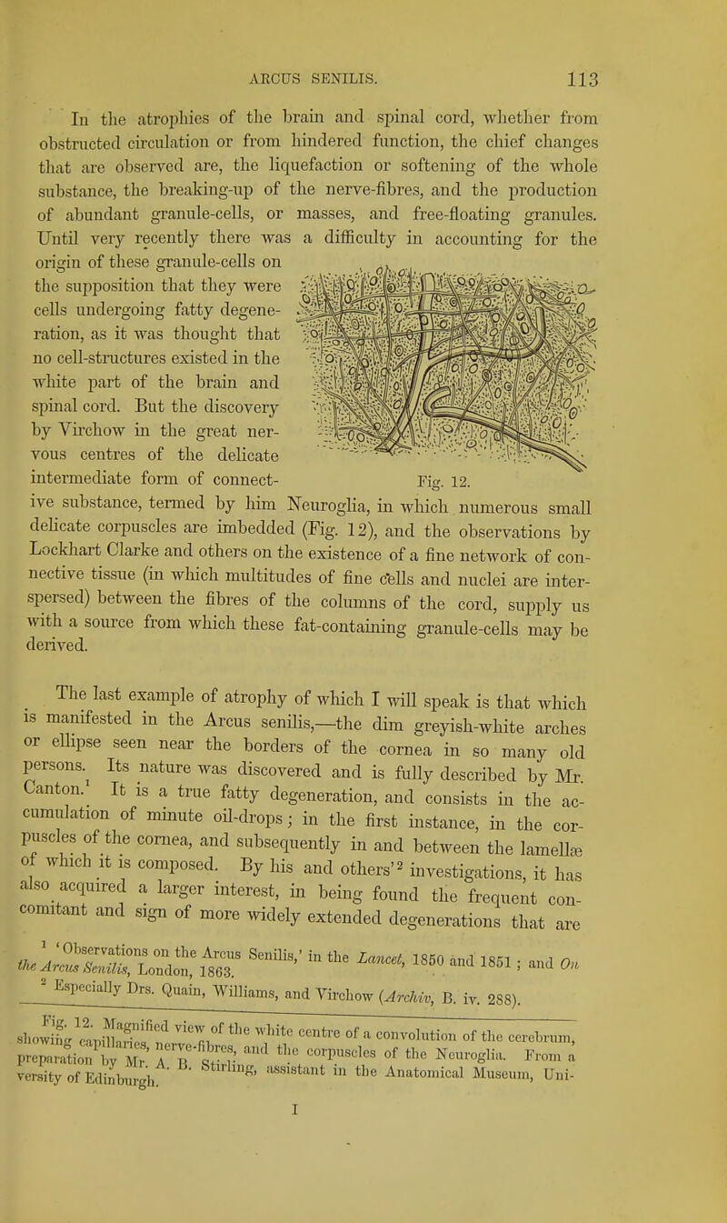 In the atrophies of tlie braiii {ind spinal cord, wliether from obstructed circulation or from hindered function, the chief changes that are observed are, the liquefaction or softening of the whole substance, the breaking-up of the nerve-fibres, and the production of abundant granule-cells, or masses, and free-floating granules. UutU very recently there was a difficulty in accounting for the origin of these granule-cells on the supposition that they were cells undergoing fatty degene- ration, as it was thought that no cell-structures existed in the white part of the brain and spinal cord. But the discovery by Virchow in the great ner- vous centres of the delicate intermediate form of connect- Fi» 12 ive substance, termed by him Neuroglia, in Avliich numerous small dehcate corpuscles are imbedded (Fig. 12), and the observations by Lockhart Clarke and others on the existence of a fine network of con- nective tissue (in which multitudes of fine c'ells and nuclei are inter- spersed) between the fibres of the columns of the cord, supply us with a source from which these fat-contaiiiing granule-cells may be derived. The last example of atrophy of which I will speak is that which IS manifested in the Arcus senilis,—the dim greyish-white arches or ellipse seen near the borders of the cornea in so many old persons.^ Its nature was discovered and is fully described by Mr Canton. It is a true fatty degeneration, and consists in the ac- cumulation of minute oil-drops; in the first instance, in the cor- puscles of the cornea, and subsequently in and between the lamella of which It IS composed. By his and others'^ investigations, it has also acquired a larger interest, in being found the frequent con- comitant and sign of more widely extended degenerations that are ' Especially Drs. Quain, WUliams, and Vircliow (JrcMv, B. iy. 288). prepa,?tio?ST sSr V^^'^^ '''' l^™ ^ versity of Edinburgh '''^ Anatomical Museum, Uni- I