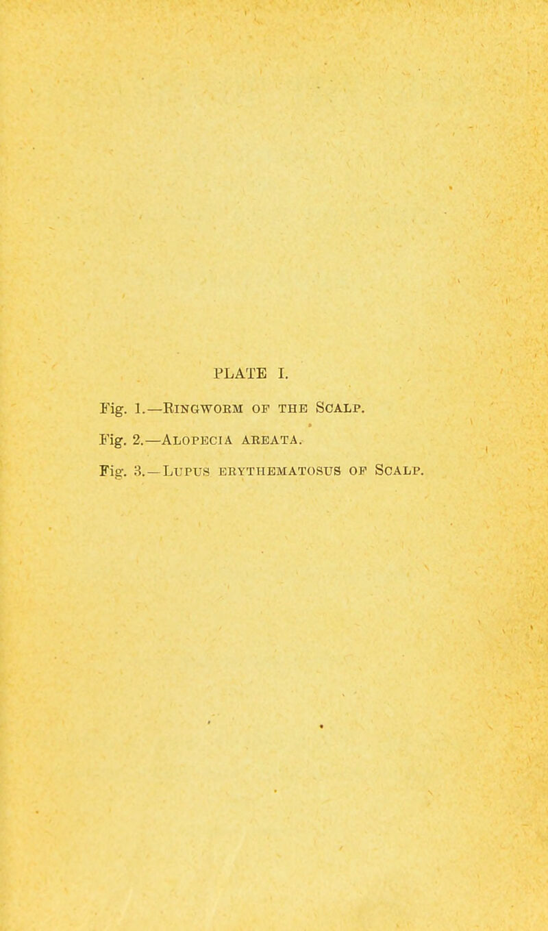 Fig. 1.— RINGWORM OF THE SCALP. Fig. 2.—Alopecia areata. Fig. 3.—Lupus erythematosus op Scalp.