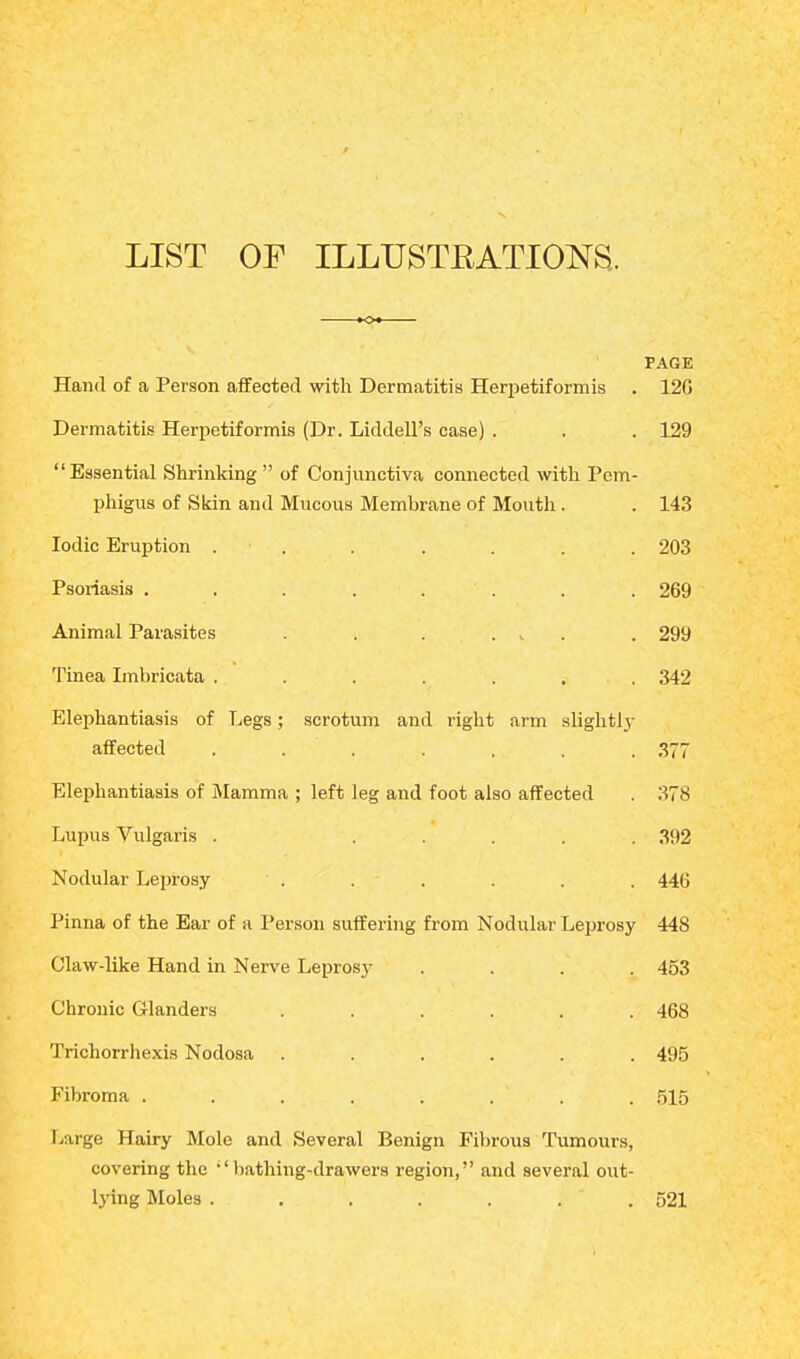 LIST OF ILLUSTKATIONS. PAGE Hand of a Person affected with Dermatitis Herpetiformis . 120 Dermatitis Herpetiformis (Dr. LiddelPs case) . . . 129 Essential Shrinking of Conjunctiva connected with Pem- phigus of Skin and Mucous Membrane of Mouth. . 143 Iodic Eruption ....... 203 Psoriasis . . . . . ' . . . 269 Animal Parasites . . . . ^ . 299 Tinea Imbricata ....... 342 Elephantiasis of Legs; scrotum and right arm slightly affected ....... 377 Elephantiasis of Mamma ; left leg and foot also affected . 378 Lupus Vulgaris . ..... 392 Nodular Leprosy  . . . . . . 44(5 Pinna of the Ear of a Person suffering from Nodular Leprosy 448 Claw-like Hand in Nerve Lepros}' .... 453 Chronic Glanders ...... 468 Trichorrhexis Nodosa ...... 495 Fibroma . . . . . . . 515 Large Hairy Mole and Several Benign Fibrous Tumours, covering the ''bathing-drawers region, and several out- lying Moles . . . . . . 521