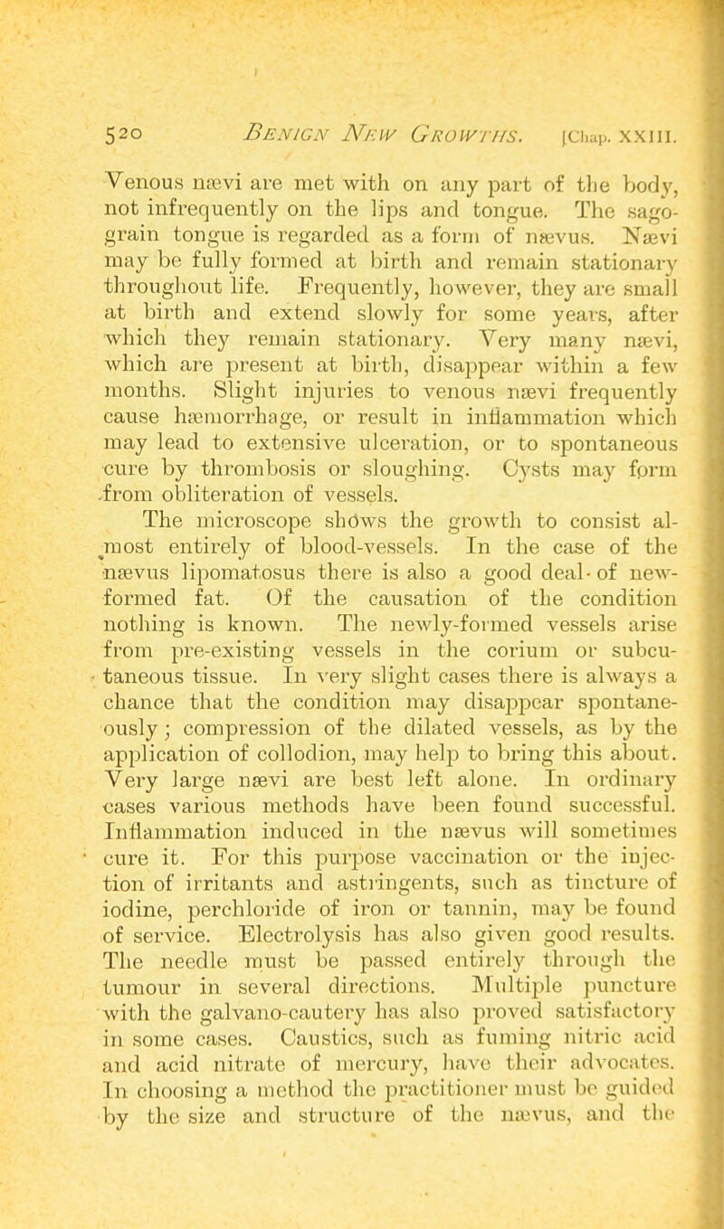 Venous nam are met with on any part of the body, not infrequently on the lips and tongue. The sago'- grain tongue is regarded as a form of nrevus. Naevi may be fully formed at birth and remain stationary throughout life. Frequently, however, they are small at birth and extend slowly for some years, after which they remain stationary. Very many nsevi, which are present at birth, disappear within a few months. Slight injuries to venous naevi frequently cause haemorrhage, or result in inflammation which may lead to extensive ulceration, or to spontaneous cure by thrombosis or sloughing. Cysts may form .from obliteration of vessels. The microscope shows the growth to consist al- nmst entirely of blood-vessels. In the case of the naevus lipomatoses there is also a good deal-of new- formed fat. Of the causation of the condition nothing is known. The newly-formed vessels arise from pre-existing vessels in the corium or subcu- taneous tissue. In very slight cases there is always a chance that the condition may disaj>pcar spontane- ously ; compression of the dilated vessels, as by the application of collodion, may help to bring this about. Very large nsevi are best left alone. In ordinary cases various methods have been found successful. Inflammation induced in the nsevus will sometimes cure it. For this purpose vaccination or the injec- tion of irritants and astringents, such as tincture of iodine, perchloride of iron or tannin, may be found of service. Electrolysis has also given good results. The needle must be passed entirely through the tumour in several directions. Multiple puncture with the galvano-cautery has also proved satisfactory in some cases. Caustics, such as fuming nitric acid and acid nitrate of mercury, have their advocates. In choosing a method the practitioner must be guided by the size and structure of the nan us, and the