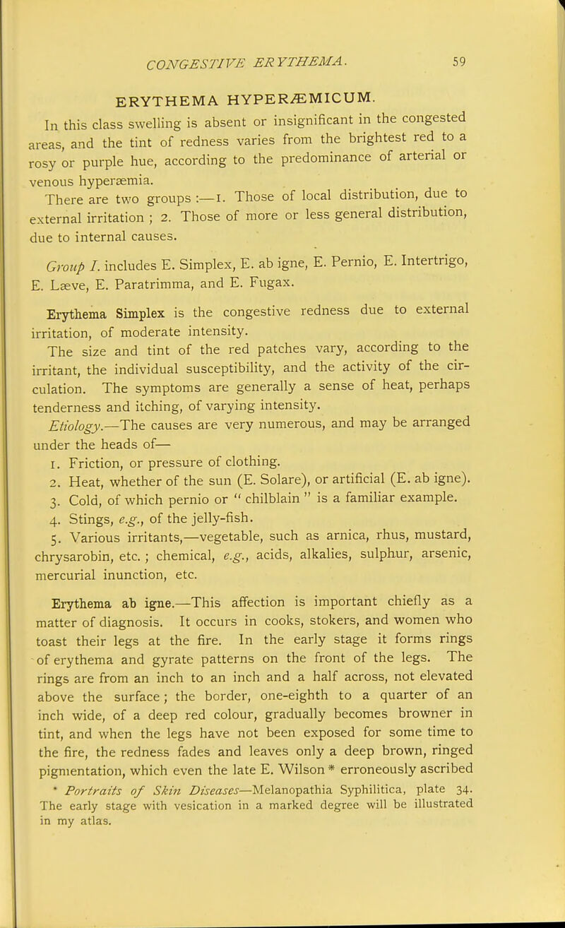 ERYTHEMA HYPER^MICUM. In this class swelling is absent or insignificant in the congested areas, and the tint of redness varies from the brightest red to a rosy 'or purple hue, according to the predominance of arterial or venous hypertonia. There are two groups :—I. Those of local distribution, due to external irritation ; 2. Those of more or less general distribution, due to internal causes. Group I. includes E. Simplex, E. ab igne, E. Pernio, E. Intertrigo, E. Laeve, E. Paratrimma, and E. Fugax. Erythema Simplex is the congestive redness due to external irritation, of moderate intensity. The size and tint of the red patches vary, according to the irritant, the individual susceptibility, and the activity of the cir- culation. The symptoms are generally a sense of heat, perhaps tenderness and itching, of varying intensity. Etiology.—The causes are very numerous, and may be arranged under the heads of— 1. Friction, or pressure of clothing. 2. Heat, whether of the sun (E. Solare), or artificial (E. ab igne). 3. Cold, of which pernio or  chilblain  is a familiar example. 4. Stings, e.g., of the jelly-fish. 5. Various irritants—vegetable, such as arnica, rhus, mustard, chrysarobin, etc. ; chemical, e.g., acids, alkalies, sulphur, arsenic, mercurial inunction, etc. Erythema ab igne.—This affection is important chiefly as a matter of diagnosis. It occurs in cooks, stokers, and women who toast their legs at the fire. In the early stage it forms rings of erythema and gyrate patterns on the front of the legs. The rings are from an inch to an inch and a half across, not elevated above the surface; the border, one-eighth to a quarter of an inch wide, of a deep red colour, gradually becomes browner in tint, and when the legs have not been exposed for some time to the fire, the redness fades and leaves only a deep brown, ringed pigmentation, which even the late E. Wilson * erroneously ascribed • Portraits of Skin Diseases—Melanopathia Syphilitica, plate 34. The early stage with vesication in a marked degree will be illustrated in my atlas.