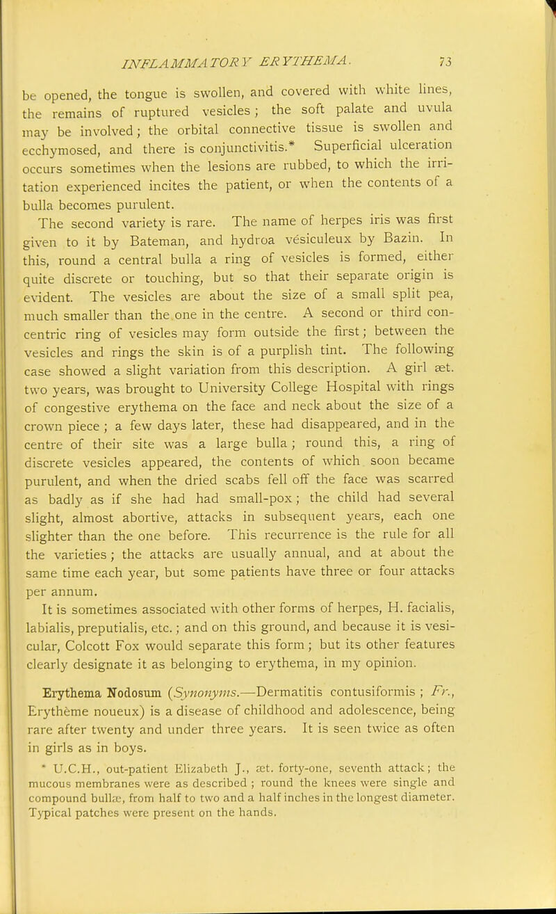 be opened, the tongue is swollen, and covered with white lines, the remains of ruptured vesicles; the soft palate and uvula may be involved; the orbital connective tissue is swollen and ecchymosed, and there is conjunctivitis.* Superficial ulceration occurs sometimes when the lesions are rubbed, to which the irri- tation experienced incites the patient, or when the contents of a bulla becomes purulent. The second variety is rare. The name of herpes iris was first given to it by Bateman, and hydroa vesiculeux by Bazin. In this, round a central bulla a ring of vesicles is formed, either quite discrete or touching, but so that their separate origin is evident. The vesicles are about the size of a small split pea, much smaller than the one in the centre. A second or third con- centric ring of vesicles may form outside the first; between the vesicles and rings the skin is of a purplish tint. The following case showed a slight variation from this description. A girl aet. two years, was brought to University College Hospital with rings of congestive erythema on the face and neck about the size of a crown piece; a few days later, these had disappeared, and in the centre of their site was a large bulla; round this, a ring of discrete vesicles appeared, the contents of which soon became purulent, and when the dried scabs fell off the face was scarred as badly as if she had had small-pox; the child had several slight, almost abortive, attacks in subsequent years, each one slighter than the one before. This recurrence is the rule for all the varieties; the attacks are usually annual, and at about the same time each year, but some patients have three or four attacks per annum. It is sometimes associated with other forms of herpes, H. facialis, labialis, preputialis, etc.; and on this ground, and because it is vesi- cular, Colcott Fox would separate this form; but its other features clearly designate it as belonging to erythema, in my opinion. Erythema Nodosum [Synonyms.—Dermatitis contusiformis ; Fr., Erytheme noueux) is a disease of childhood and adolescence, being rare after twenty and under three years. It is seen twice as often in girls as in boys.  U.C.H., out-patient Elizabeth J., xt. forty-one, seventh attack; the mucous membranes were as described ; round the knees were single and compound bulla;, from half to two and a half inches in the longest diameter. Typical patches were present on the hands.