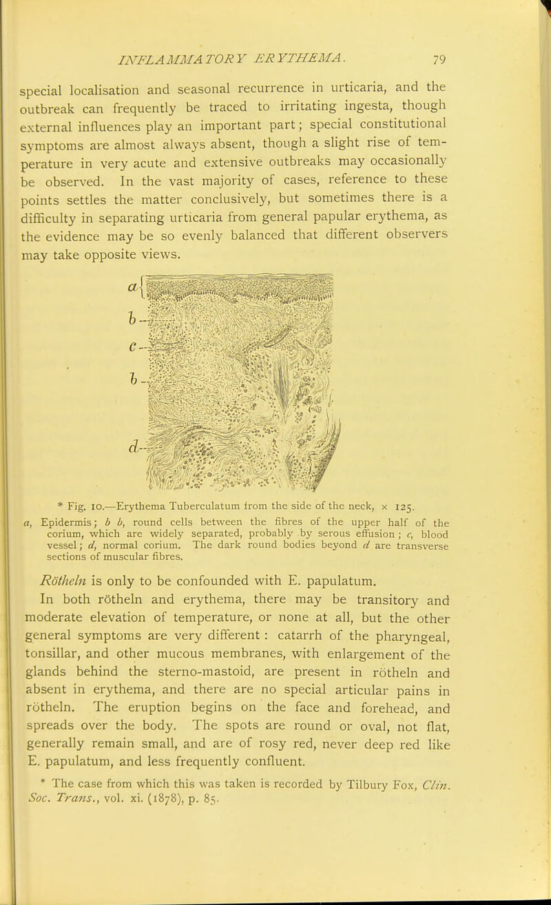 special localisation and seasonal recurrence in urticaria, and the outbreak can frequently be traced to irritating ingesta, though external influences play an important part; special constitutional symptoms are almost always absent, though a slight rise of tem- perature in very acute and extensive outbreaks may occasionally be observed. In the vast majority of cases, reference to these points settles the matter conclusively, but sometimes there is a difficulty in separating urticaria from general papular erythema, as the evidence may be so evenly balanced that different observers may take opposite views. c-L I--; * Fig. 10.—Erythema Tuberculatum irom the side of the neck, x 125. a, Epidermis; b b, round cells between the fibres of the upper half of the corium, which are widely separated, probably by serous effusion ; c, blood vessel; d, normal corium. The dark round bodies beyond d are transverse sections of muscular fibres. Rotheln is only to be confounded with E. papulatum. In both rotheln and erythema, there may be transitory and moderate elevation of temperature, or none at all, but the other general symptoms are very different : catarrh of the pharyngeal, tonsillar, and other mucous membranes, with enlargement of the glands behind the sterno-mastoid, are present in rotheln and absent in erythema, and there are no special articular pains in rotheln. The eruption begins on the face and forehead, and spreads over the body. The spots are round or oval, not flat, generally remain small, and are of rosy red, never deep red like E. papulatum, and less frequently confluent. * The case from which this was taken is recorded by Tilbury Fox, Clin. Soc. Trans., vol. xi. (1878), p. 85.