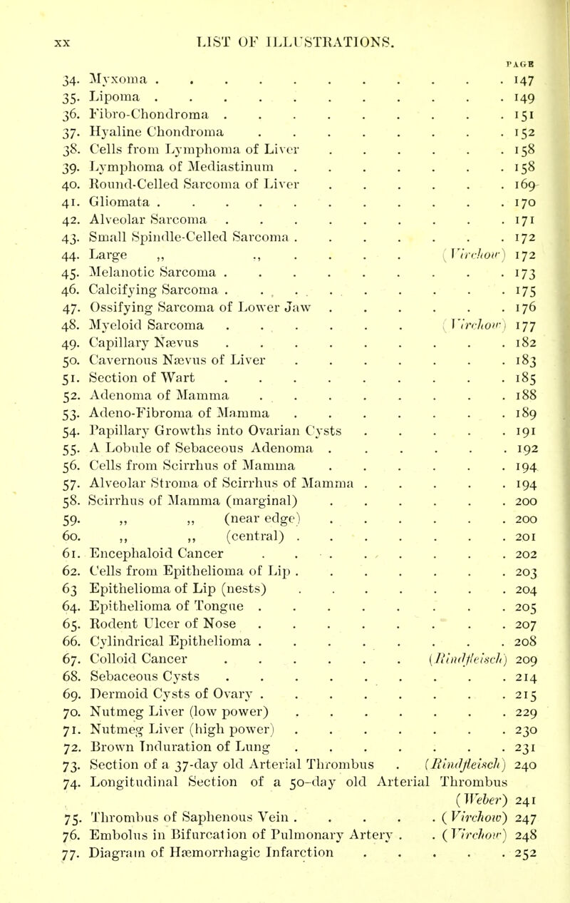 34. jVIyxoma . . . . . . . . . . • 147 35. Lipoma 149 36. Fibro-Chondroma 151 ! 37. Hyaline Chondroma 152 38. Cells from Lymphoma of Liver . . . . . .158 39. Lymphoma of Mediastinum . . , . . . .158 40. Round-Celled Sarcoma of Liver . . . . . .169 41. Gliomata 170 42. Alveolar Sarcoma . . . . . . . . -171 43. Small Spindle-Celled Sarcoma . . . . . . .172 44. Large ,, ...... Vinlioir) 172 45. Melanotic Sarcoma . . . . . . . . -173 46. Calcifying Sarcoma . .... . . . -175 47. Ossifying Sarcoma of Lower Jaw 176 48. Myeloid Sarcoma ...... Vlrclioiri 177 49. Capillary Najvus . . . . . . . . .182 50. Cavernous Naavus of Liver . . . . . . .183 51. Section of Wart 185 52. Adenoma of Mamma . . . . . . . .188 53. Adeno-Fibroma of Mamma . . . . . . .189 54. Papillary Growths into Ovarian Cysts . . . . .191 55. A Lobule of Sebaceous Adenoma . . . . . .192 56. Cells from Scirrhus of Mamma . . . . . .194 57. Alveolar Stroma of Scirrhus of Mamma ..... 194 58. Scirrhus of Mamma (marginal) 200 59. „ (near edge) 200 60. ,, ,, (central) 201 61. Encephaloid Cancer . . . . . . . . 202 62. Cells from Epithelioma of Lip ....... 203 63 Epithelioma of Lip (nests) 204 64. Epithelioma of Tongue ........ 205 65. Rodent Ulcer of Nose . 207 66. Cylindrical Epithelioma 208 67. Colloid Cancer ...... {Jilnilf'elscli) 209 68. Sebaceous Cysts . . . . . . . . .214 69. Dermoid Cysts of Ovary 215 70. Nutmeg Liver (low power) 229 71. Nutmeg Liver (high power) ....... 230 72. Brow^n Induration of Lung . . . . . . .231 73. Section of a 37-day old Arterial Thrombus . (lUmJjieisch) 240 74. Longitudinal Section of a 50-day old Arterial Thrombus (Wehe?-) 241 75. Thrombus of Saphenous Vein ( Virchoio) 247 76. Embolus in Bifurcation of Pulmonary Arter}- . . (Vh'chon-) 248 77. Diagram of Hasmorrhagic Infarction . . . . . 252