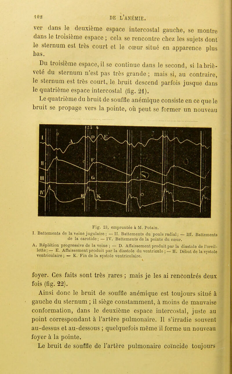 ver dans le deuxième espace intercostal gauche, se montre dans le troisième espace ; cela se rencontre chez les sujets dont le sternum est très court et le cœur situé en apparence plus bas. Du troisième espace, il se continue dans le second, si la briè- veté du sternum n'est pas très grande ; mais si, au contraire, le sternum est très court, le bruit descend parfois jusque dans le quatrième espace intercostal (fig. 21). Le quatrième du bruit de souffle anémique consiste en ce que le bruit se propage vers la pointe, où peut se former un nouveau Fig. 23, empruntée à M. Potain. I. Battements de la veine jugulaire ; — H. Battements du pouls radial; — III. Battements de la carotide ; — IV. Battements de la pointe du cœur. A. Réplétion progressive de la veine ; — D. Affaissement produit par la diastole de l'oreil- lette;— E. Affaissement produit par la diastole du ventricule ;—H. Début de la systole ventriculaire ; — K. Fin de la systole ventriculaire. foyer. Ces faits sont très rares ; mais je les ai rencontrés deux fois (fig. 22). Ainsi donc le bruit de souffle anémique est toujours situé à ' gauche du sternum ; il siège constamment, à moins de mauvaise conformation, dans le deuxième espace intercostal, juste au point correspondant à l'artère pulmonaire. Il s'irradie souvent au-dessus et au-dessous ; quelquefois même il forme un nouveau foyer à la pointe. Le bruit de souffle de l'artère pulmonaire coïncide toujours