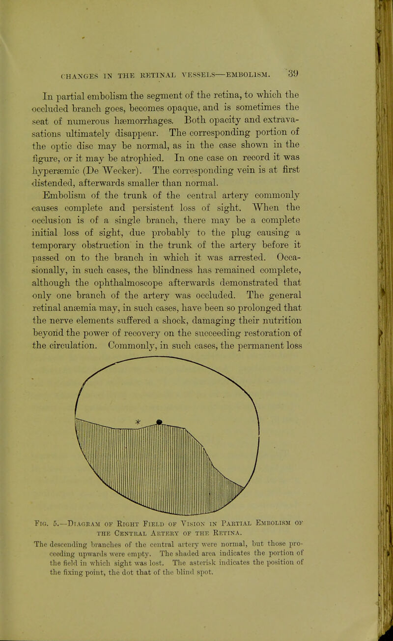 In partial embolism the segment of tJie retina, to which the occluded branch goes, becomes opaque, and is sometimes the seat of numerous htemorrhages. Both opacity and extrava- sations ultimately disappear. The corresponding portion of the optic disc may be normal, as in the case shown in the figure, or it may be atrophied. In one case on record it was hyper£emic (De Wecker). The corresponding vein is at first distended, afterwards smaller than normal. Embohsm of. the trunk of the central artery commonly ■causes complete and persistent loss of sight. When the occlusion is of a single branch, there may be a complete initial loss of sight, due probably to the plug causing a temporary obstruction in the trunk of the artery before it passed on to the branch in which it was arrested. Occa- sionally, in such cases, the blindness has remained complete, although the ophthalmoscope afterwards demonstrated that •only one branch of the artery was occluded. The general retinal antemia may, in such cases, have been so prolonged that the nerve elements suffered a shock, damaging their nutrition beyond the power of recovery on the succeeding restoration of the circulation. Commonly, in such cases, the permanent loss Fig. 5.—Dtagbam of Right Field of Vision in Partial Embolism of THE Central Aiitery of the Retina. The descending liranclies of the centi-al artery were normal, but those pro- ceeding upwards were empty. The shaded area indicates the portion of the field in which sight was lost. The asterisk indicates the position of the fixing point, the dot that of the blind spot.