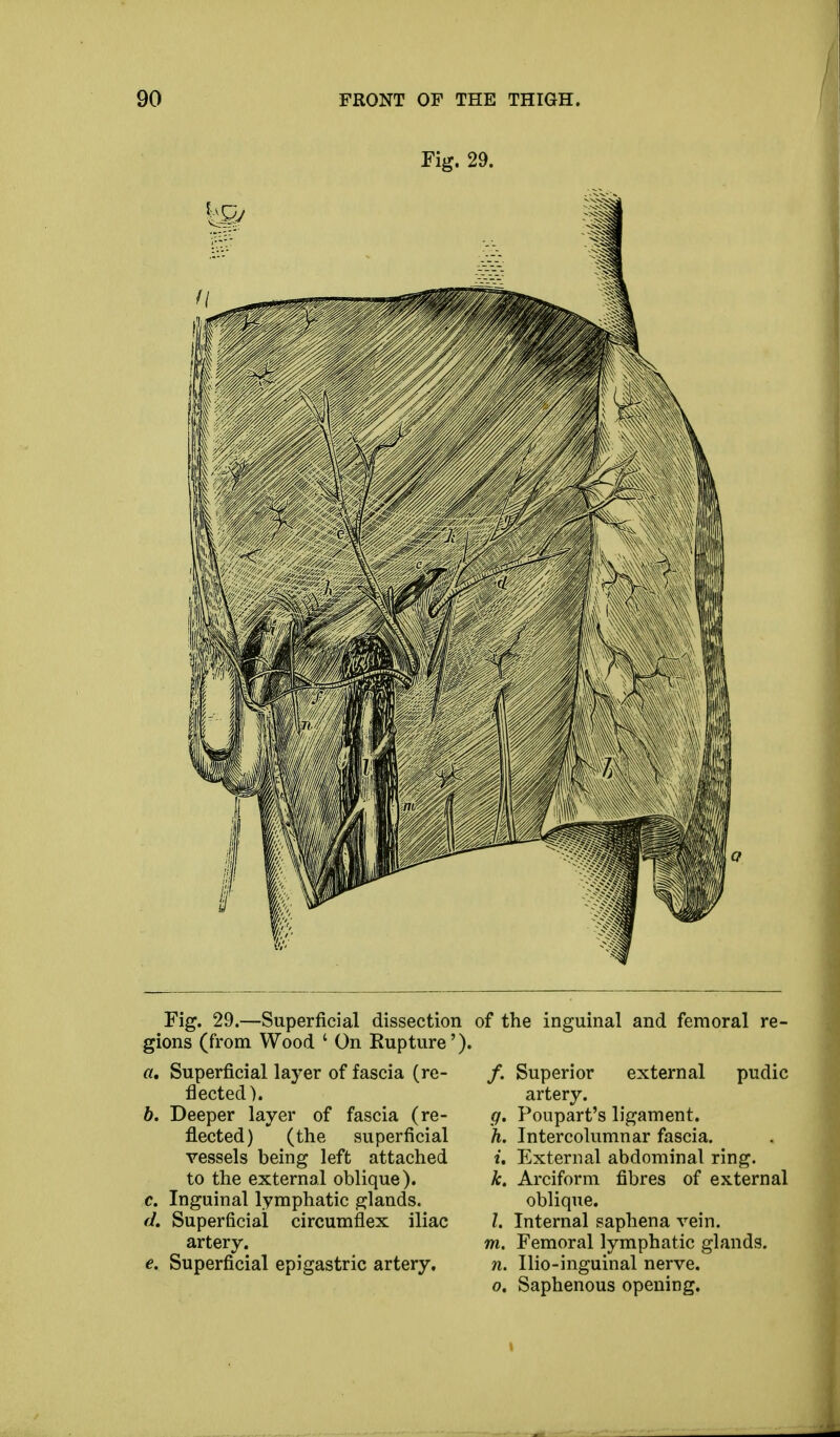 Fig. 29. Fig. 29.—Superficial dissection gions (from Wood ' On Rupture') «. Superficial layer of fascia (re- flected). b. Deeper layer of fascia (re- flected) (the superficial vessels being left attached to the external oblique). c. Inguinal lymphatic glands. d. Superficial circumflex iliac artery. e. Superficial epigastric artery. of the inguinal and femoral re- /. Superior external pudic artery. g. Poupart's ligament. h. Intercolumnar fascia. i. External abdominal ring. k. Arciform fibres of external oblique. I. Internal saphena vein. m. Femoral lymphatic glands. n. Ilio-inguinal nerve. o. Saphenous opening.