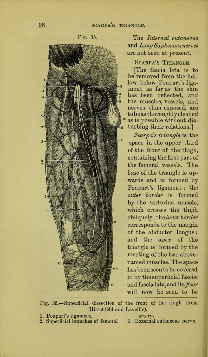 Fig. 35. The Internal cutaneous and Long' Sapke?ious nerves are not seen at present. Scarpa's Triangle. [The fascia lata is to be removed from the hol- low below Poupart's liga- ment as far as the skin has been reflected, and the muscles, vessels, and nerves thus exposed, are to be as thoroughly cleaned as is possible without dis- turbing their relations.] Scarpa's triangle is the space in the upper third of the front of the thigh, containing the first part of the femoral vessels. The base of the triangle is up- wards and is formed by Poupart's ligament; the outer border is formed by the sartorius muscle, which crosses the thigh obliquely; the inner border corresponds to the margin of the abductor longus; and the ayex of the triangle is formed by the meeting of the two above- named muscles. The space hasbeenseentobe covered in by the superficial fascise and fascia lata, and its floor will now be seen to be Pig. 35.—Superficial dissection of the front of the thigh (from Hirschfeld and Leveille'). 1. Poupart's ligament. artery. 2. Superficial branches of femoral 3. External cutaneous nerve. i