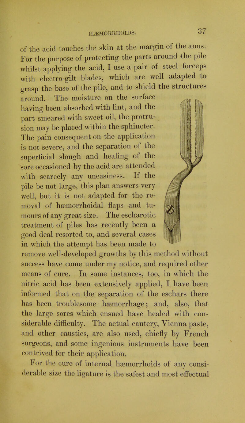 of the acid touches the skin at the margin of the anus. For the purpose of protecting the parts around the pile whilst applying the acid, I use a pair of steel forceps with electro-gilt blades, which are well adapted to grasp the base of the pile, and to shield the structures around. The moisture on the surface having been absorbed with lint, and the part smeared with sweet oil, the protru- sion may be placed within the sphincter. The pain consequent on the application is not severe, and the separation of the superficial slough and healing of the sore occasioned by the acid are attended with scarcely any uneasiness. If the pile be not large, this plan answers very well, but it is not adapted for the re- moval of hsemorrhoidal flaps and tu- mours of any great size. The escharotic treatment of piles has recently been a good deal resorted to, and several cases in which the attempt has been made to remove well-developed growths by this method without success have come under my notice, and required other means of cure. In some instances, too, in which the nitric acid has been extensively applied, I have been informed that on the separation of the eschars there has been troublesome haemorrhage; and, also, that the large sores which ensued have healed with con- siderable difficulty. The actual cautery, Vienna paste, and other caustics, are also used, chiefly by French surgeons, and some ingenious instruments have been contrived for their application. For the cure of internal haemorrhoids of any consi- derable size the ligature is the safest and most effectual