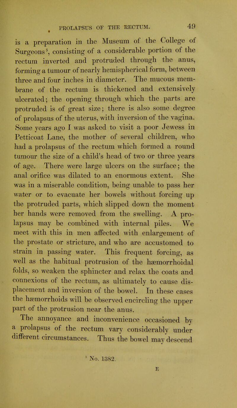 is a preparation in the Museum of the College of Surgeons % consisting of a considerable portion of the rectum inverted and protruded through the anus, forming a tumour of nearly hemispherical form, between three and four inches in diameter. The mucous mem- brane of the rectum is thickened and extensively ulcerated; the opening through which the parts are protruded is of great size; there is also some degree of prolapsus of the uterus, with inversion of the vagina. Some years ago I was asked to visit a poor Jewess in Petticoat Lane, the mother of several children, who had a prolapsus of the rectum which formed a round tumour the size of a child's head of two or three years of age. There were large ulcers on the surface; the anal orifice was dilated to an enormous extent. She was in a miserable condition, being unable to pass her water or to evacuate her bowels without forcing up the protruded parts, which slipped down the moment her hands were removed from the swelling. A pro- lapsus may be combined with internal piles. We meet with this in men affected with enlargement of the prostate or stricture, and who are accustomed to strain in passing water. This frequent forcing, as well as the habitual protrusion of the hsemorrhoidal folds, so weaken the sphincter and relax the coats and connexions of the rectum, as ultimately to cause dis- placement and inversion of the bowel. In these cases the haemorrhoids will be observed encircling the upper part of the protrusion near the anus. The annoyance and inconvenience occasioned by a prolapsus of the rectum vary considerably under different circumstances. Thus the bowel may descend ' No. 1382. E