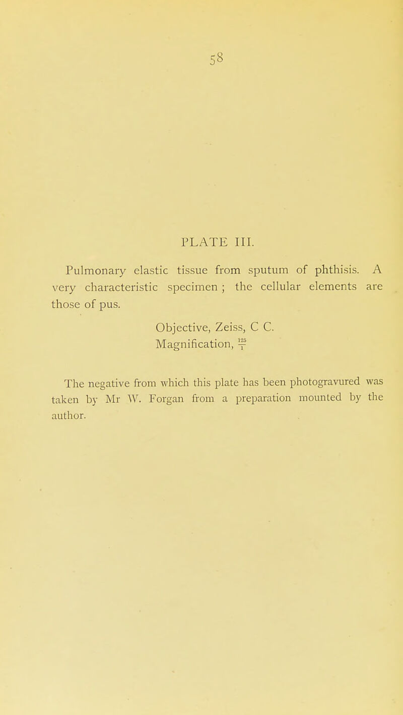 58 PLATE III. Pulmonary elastic tissue from sputum of phthisis. A very characteristic specimen ; the cellular elements are those of pus. Objective, Zeiss, C C. Magnification, The negative from which this plate has been photogravured was taken by Mr W. Forgan from a preparation mounted by the author.