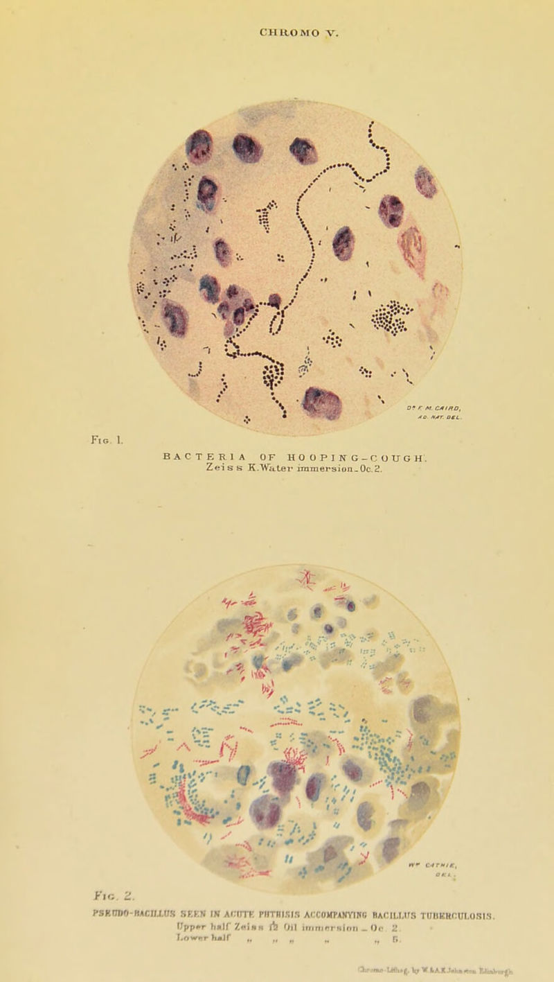 CHltOMO V. • % « re MO. fli»T. OtL. Fig. 1. BACTERIA OF HOOPING-COUGH. Zeiss K.'WkLei' iramersioii-OcS. Kic. 2, PSRtlDO-BAClUfrS SEEN XH ALIITE PIITHISIS Ai;COHPAHVIHIi BAClLI.IfS TUHEHOULOSIS. IJpp»T hnirZninn (S Oil iiiiniri Hiiiii _ Or 2 I.ow»irh»jr „ ., „ .. n.