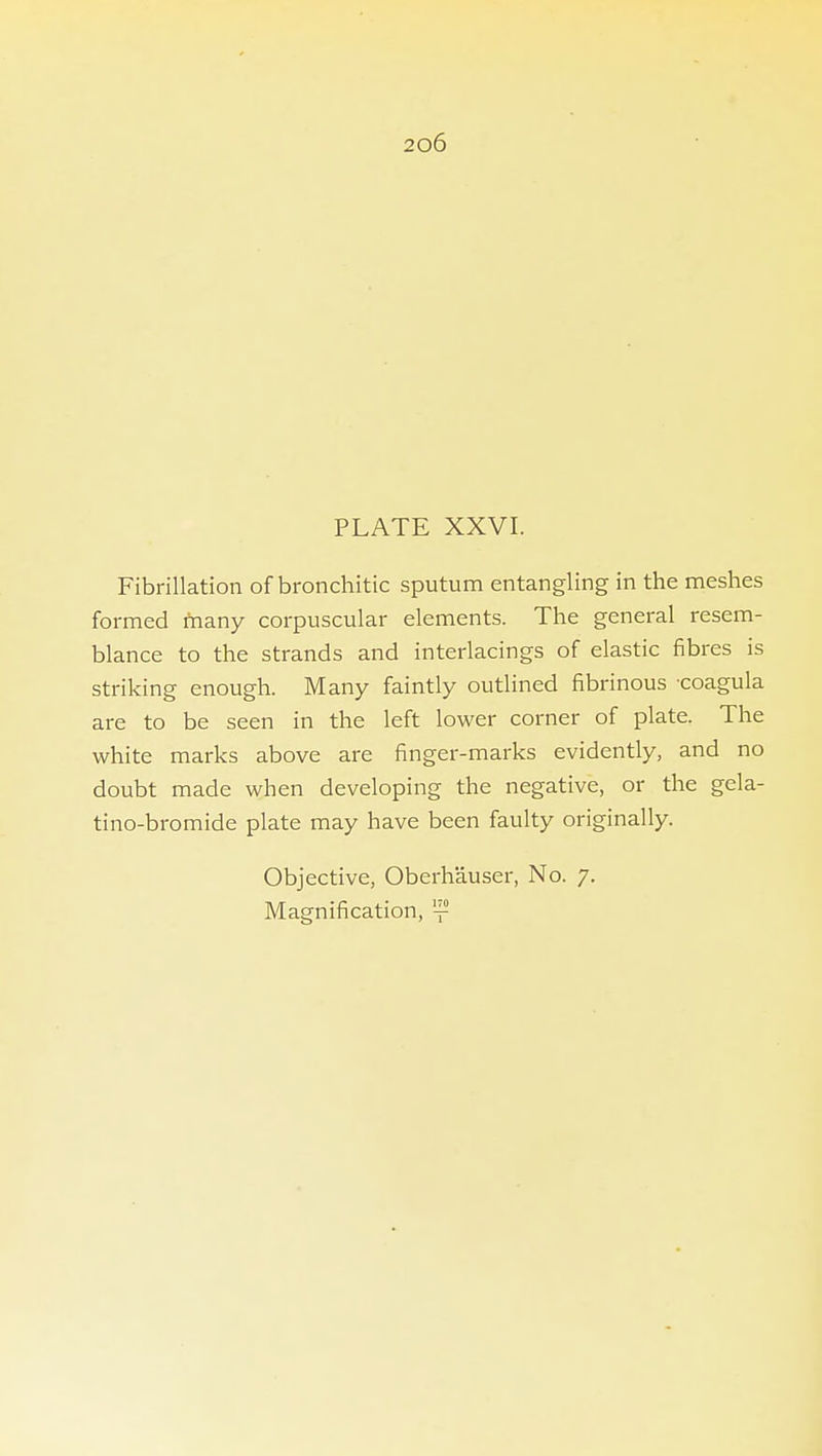 2o6 PLATE XXVI. Fibrillation of bronchitic sputum entangling in the meshes formed many corpuscular elements. The general resem- blance to the strands and interlacings of elastic fibres is striking enough. Many faintly outlined fibrinous coagula are to be seen in the left lower corner of plate. The white marks above are finger-marks evidently, and no doubt made when developing the negative, or the gela- tino-bromide plate may have been faulty originally. Objective, Oberhauser, No. 7.