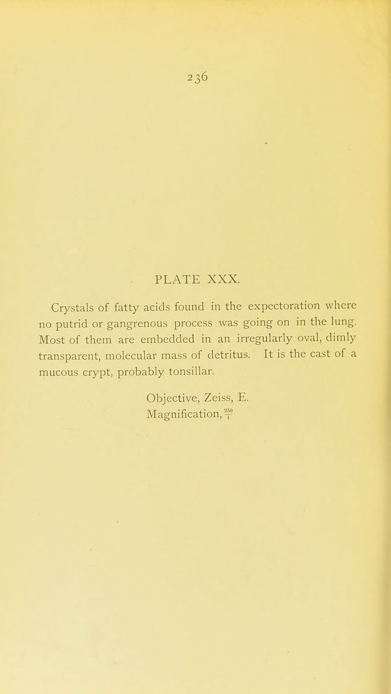 PLATE XXX. Crystals of fatty acids found in the expectoration where no putrid or gangrenous process was going on in the lung. Most of them are embedded in an irregularly oval, dimly transparent, molecular mass of detritus. It is the cast of a mucous crypt, probably tonsillar. Objective, Zeiss, E. Magnification,°