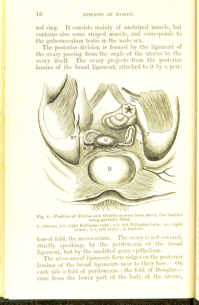 nal ring. It consists mainly of nnstriped muscle, but contains also some striped muscle, and corresponds to the gubcrnaculnm testis in the male sex. The posterior division is formed by the ligament of the ovary passing from the angle of the uterus to the ovary itself. The ovary projects from the posterior lamina of the broad ligament, attached to it by a peri- Pit,. H.—Positiiiii of uterus ana Ovaries ns seen from above, Die lilad.lcr lieiiig partially iilled. U uterus- HT, rifiht, Fallopian tube ; ],T. loft Fallopian t ube ; xo, riiilit ' ' ovary ; l. o, left ovary ; li, blailder. toncal fold, the mesovariiiin. Tlie ovary is not covered, strictly six-aking, by llie ])i>rit(Hieiiin of tlie broad ligament, but by the niodihed germ epitlielium. Tlie ii/n-o-'iac'rdl Jinaments io\m ridges on tlie posterior laiiiintr ol' llie l)ro:id ligaments near to their base. On ciicli side a fobl oF peritoneum—the fold of Douglas- runs fiom the lower part of the body of the uterus.