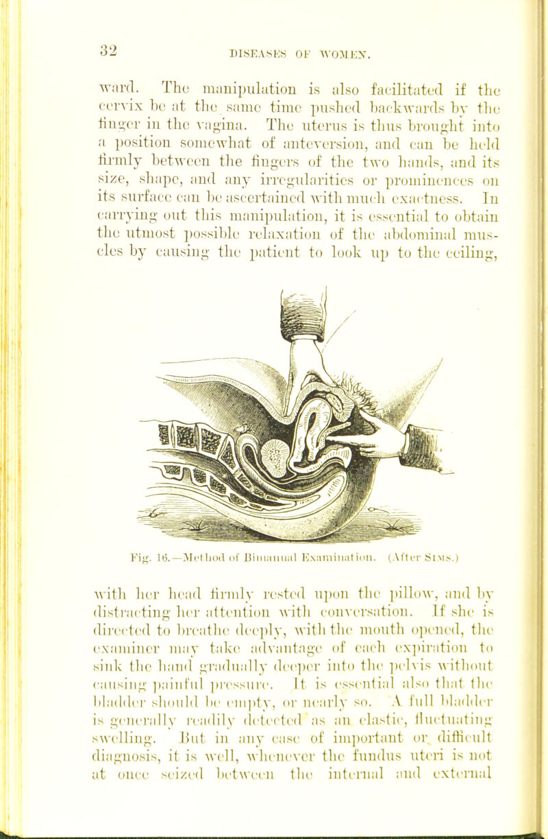 dlst;.vse8 of WOMKX. ward. The manipulation is also facilitated if the cervix be at the same time jnished backwards by the tiu^'cr in the vagina. The uterus is thus brought into a position somewhat of anteversion, and can be held firmly between the fingers of the two hands, and its size, sliapc, and any irregxdarities or prominences on its surface can be ascertained -with much exactness. In carrying out this manipulation, it is essential to obtain the utmost possil)le relaxation of the abdominal mus- cles by causing the patient to look up to the ceiling, Vv^. lii—Mi'l licul (il JjiiiKiiiual H.\;iniiiint idii. (Afl cr Si M.'i.) with her head linidy i'cste(l u])on the pillow, and by disti'acting lier altcnlion with conversation. If she is directed to breathe deeply, with the mouth opened, the e.vaminer may take advantage of each exi)iration to siidv tlie li;nid gradually dcc])er into the ])elvis without causing ])ainl'iil pressure. It is essential also that tlu' liladdci' slionid be empty, or nearly so. .\ full bladiler is generally readily detected as an elastic, lluctuating swelling. Jhit in any case of imjiortant or difficult diagnosis, it is well, whenever the fundus uteri is not at once seized between the intt'nial and external